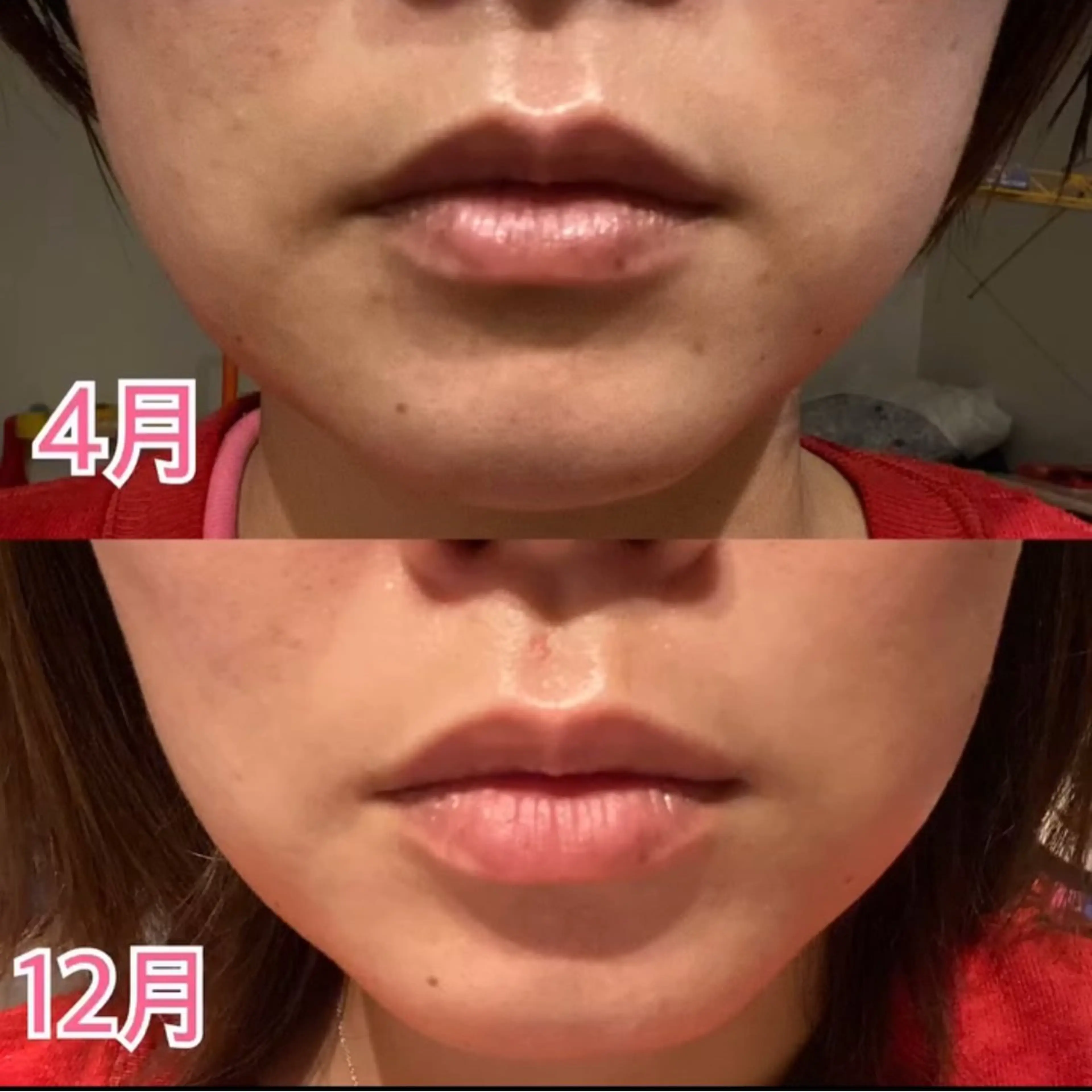 エステ ビューティーサロン　プリズム所属・久留本 茜のエステ・リラクイメージ