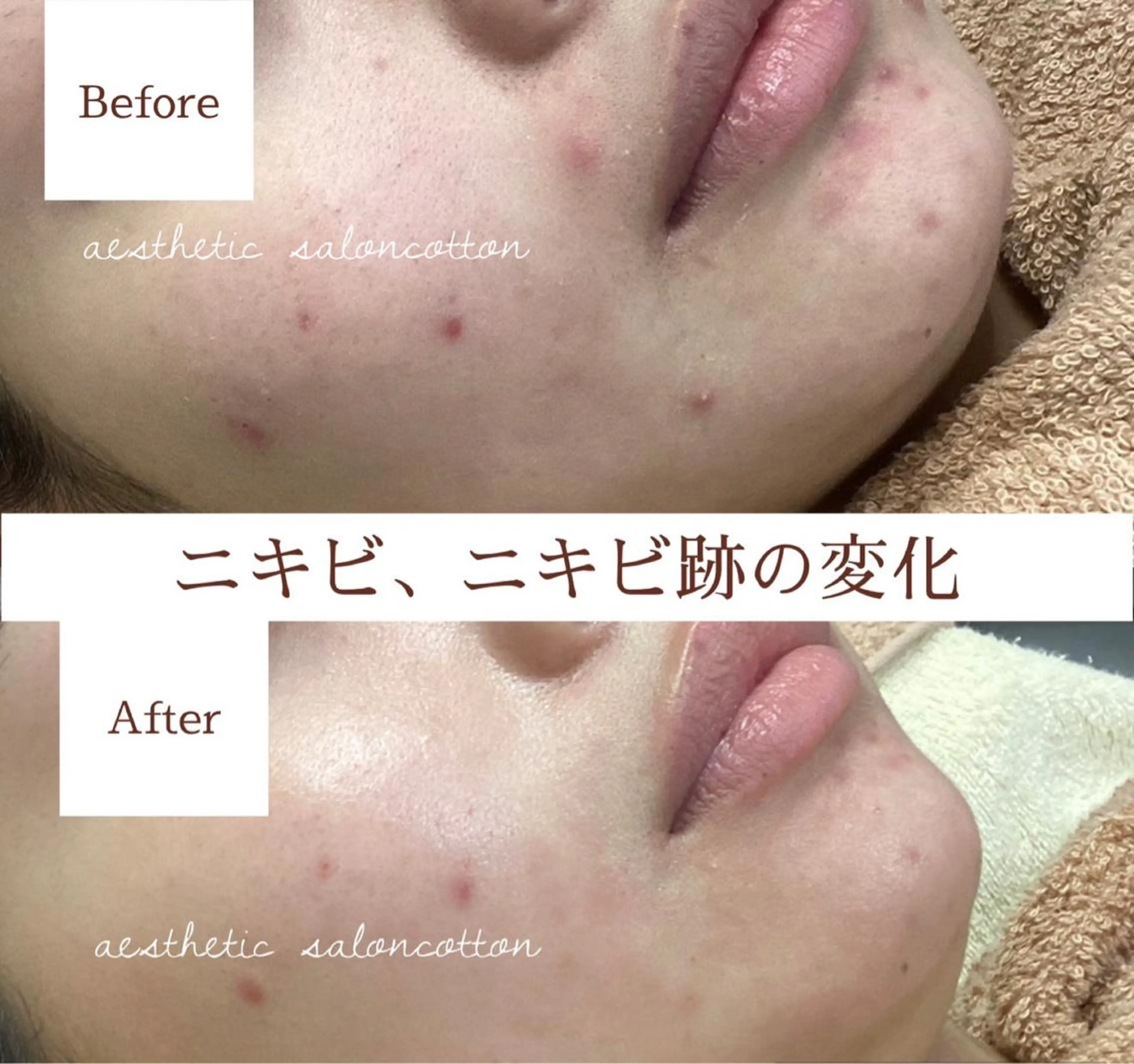 都度払い 肌質改善専門サロンのエステ・リラクイメージ