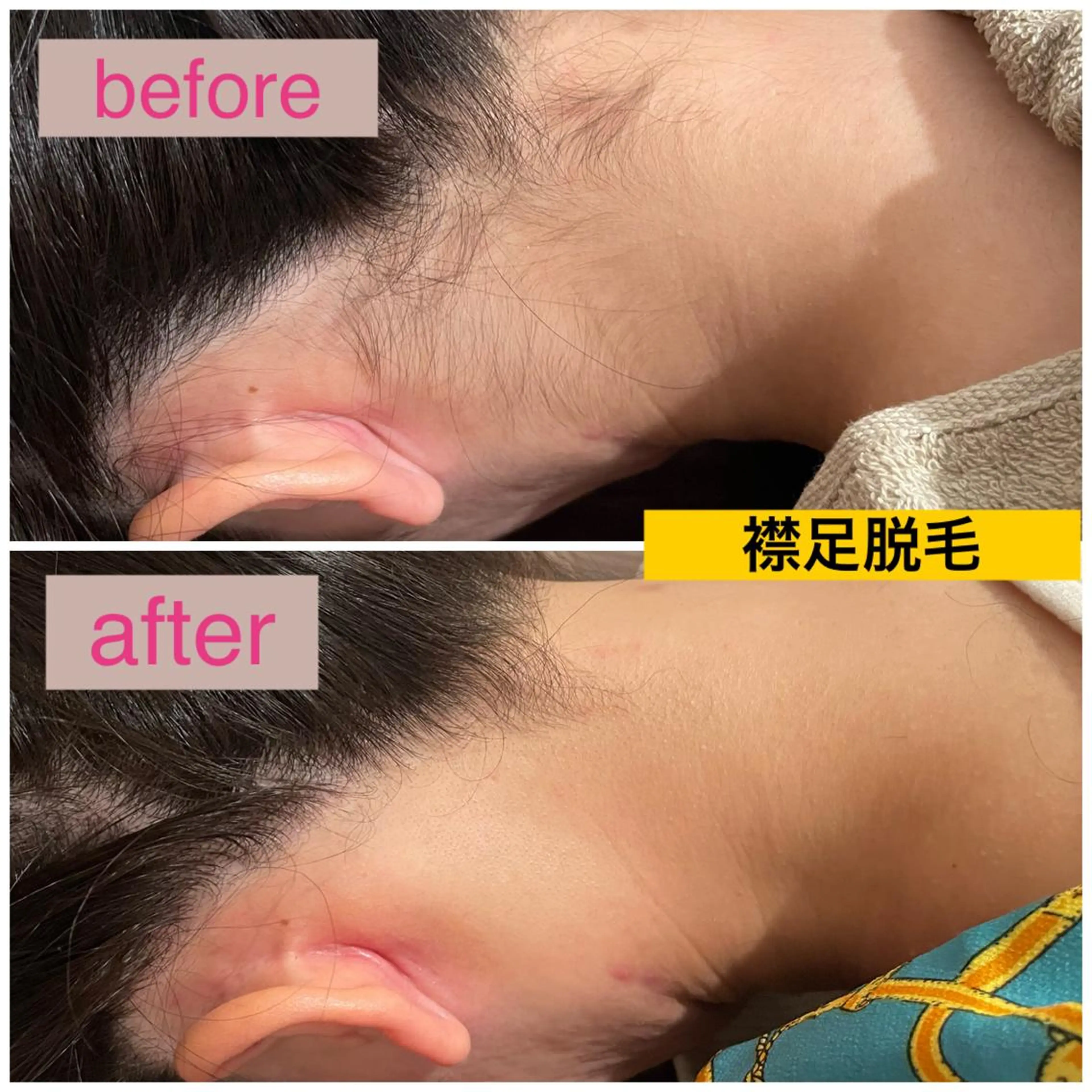 美肌脱毛サロン LaPe'aのエステ・リラクイメージ