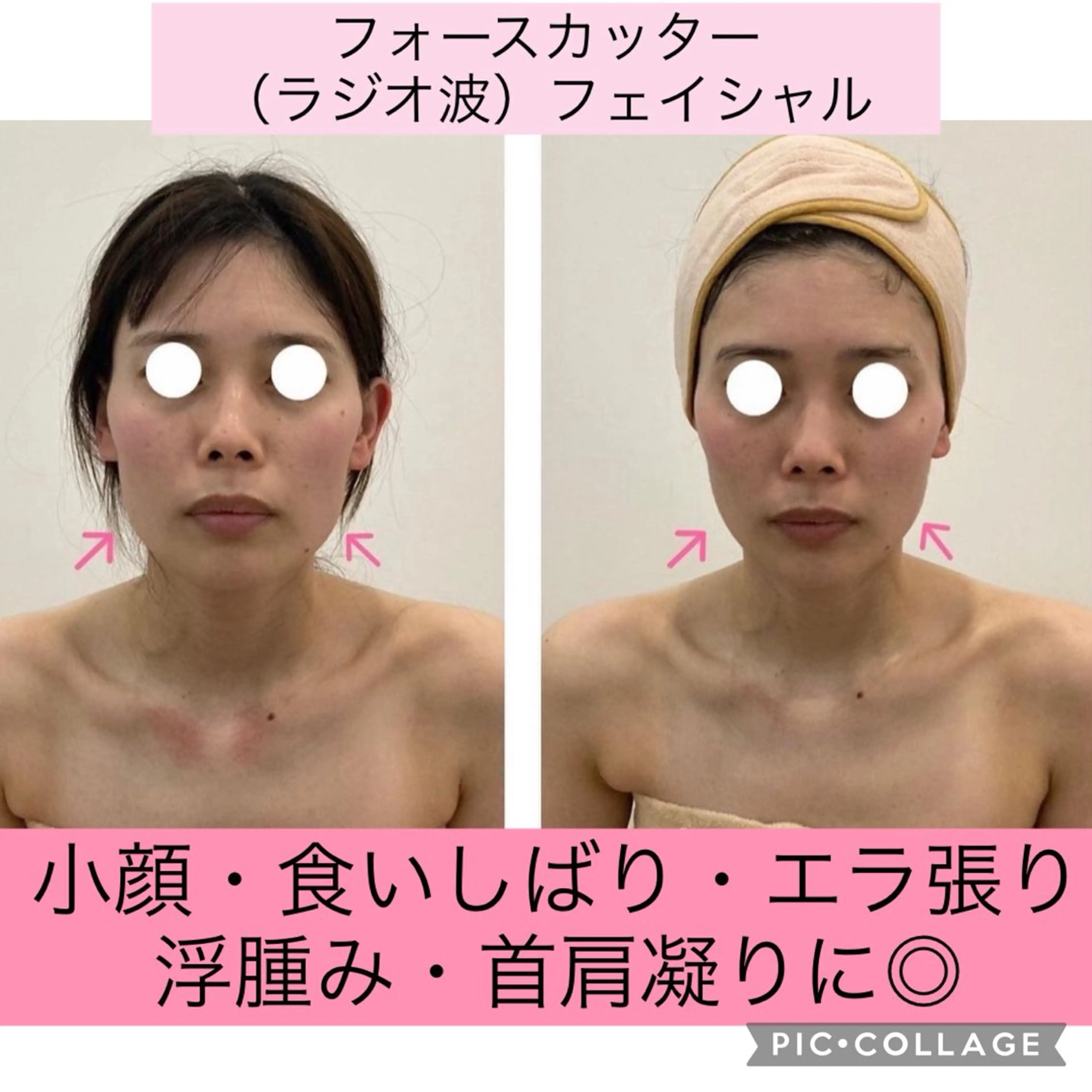 ブライダル痩身×脱毛 尼崎駅前サロンのエステ・リラクイメージ