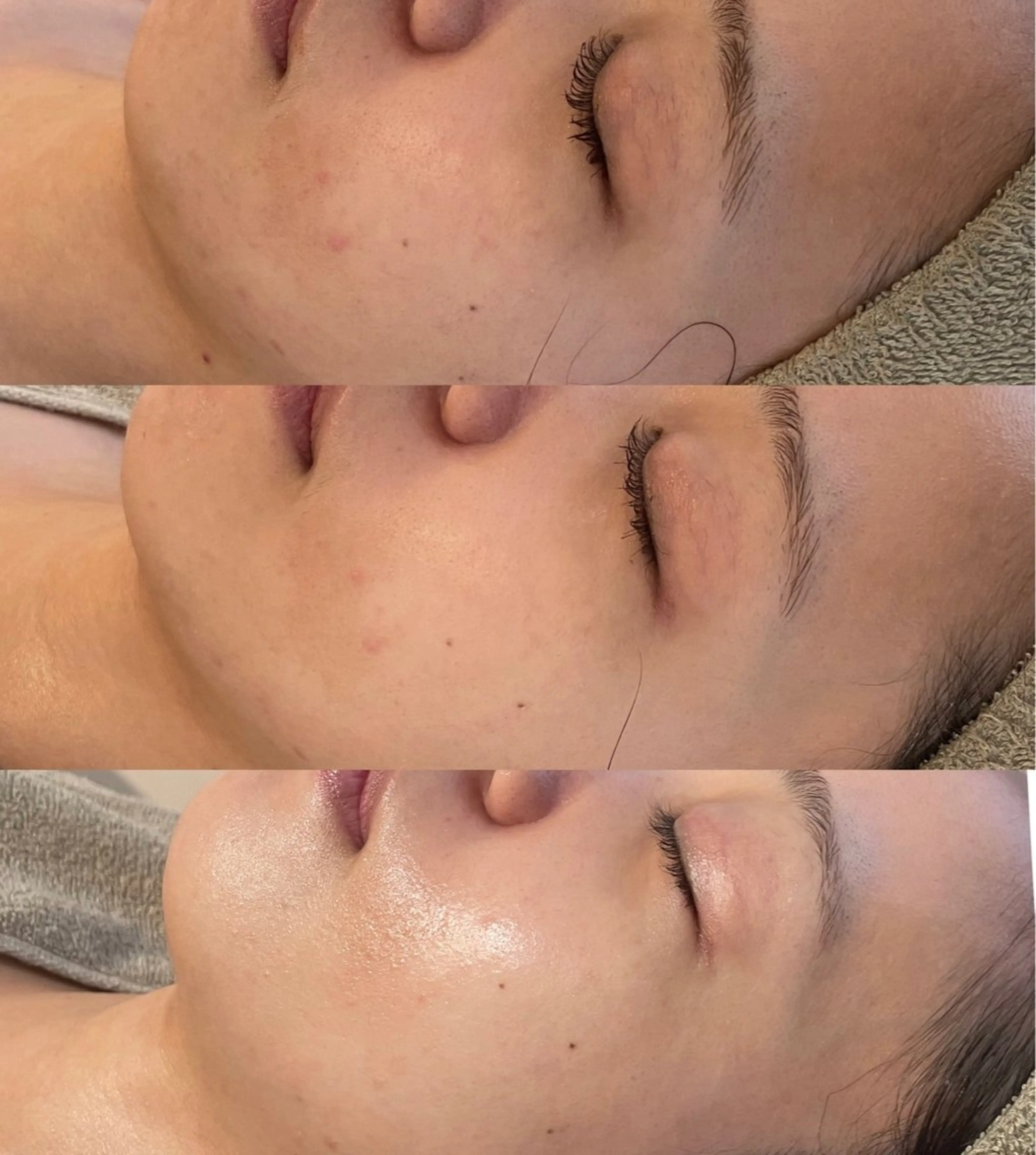 中目黒ハーブピーリン グ🌿ララピールのエステ・リラクイメージ