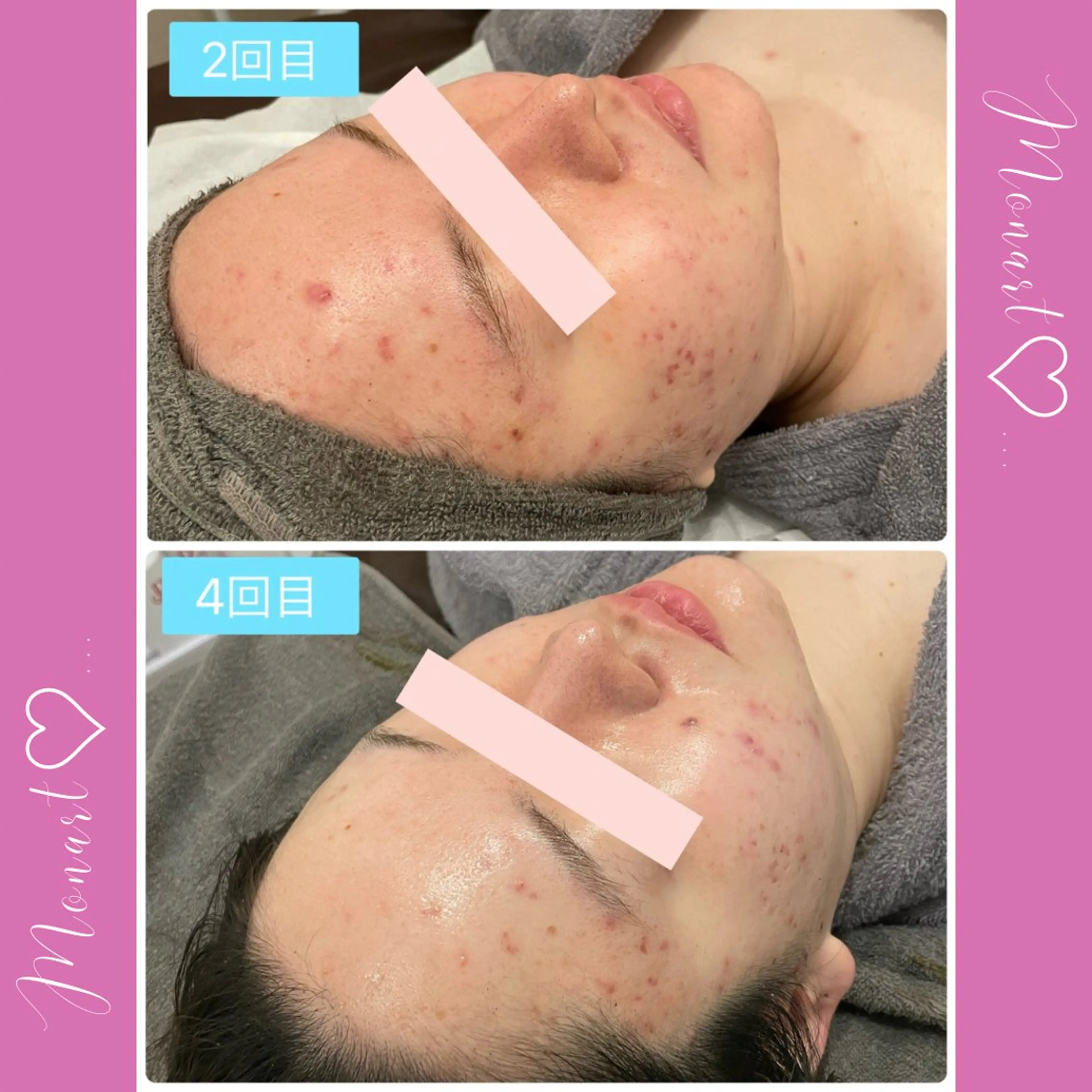 Monart -deux-のエステ・リラクイメージ