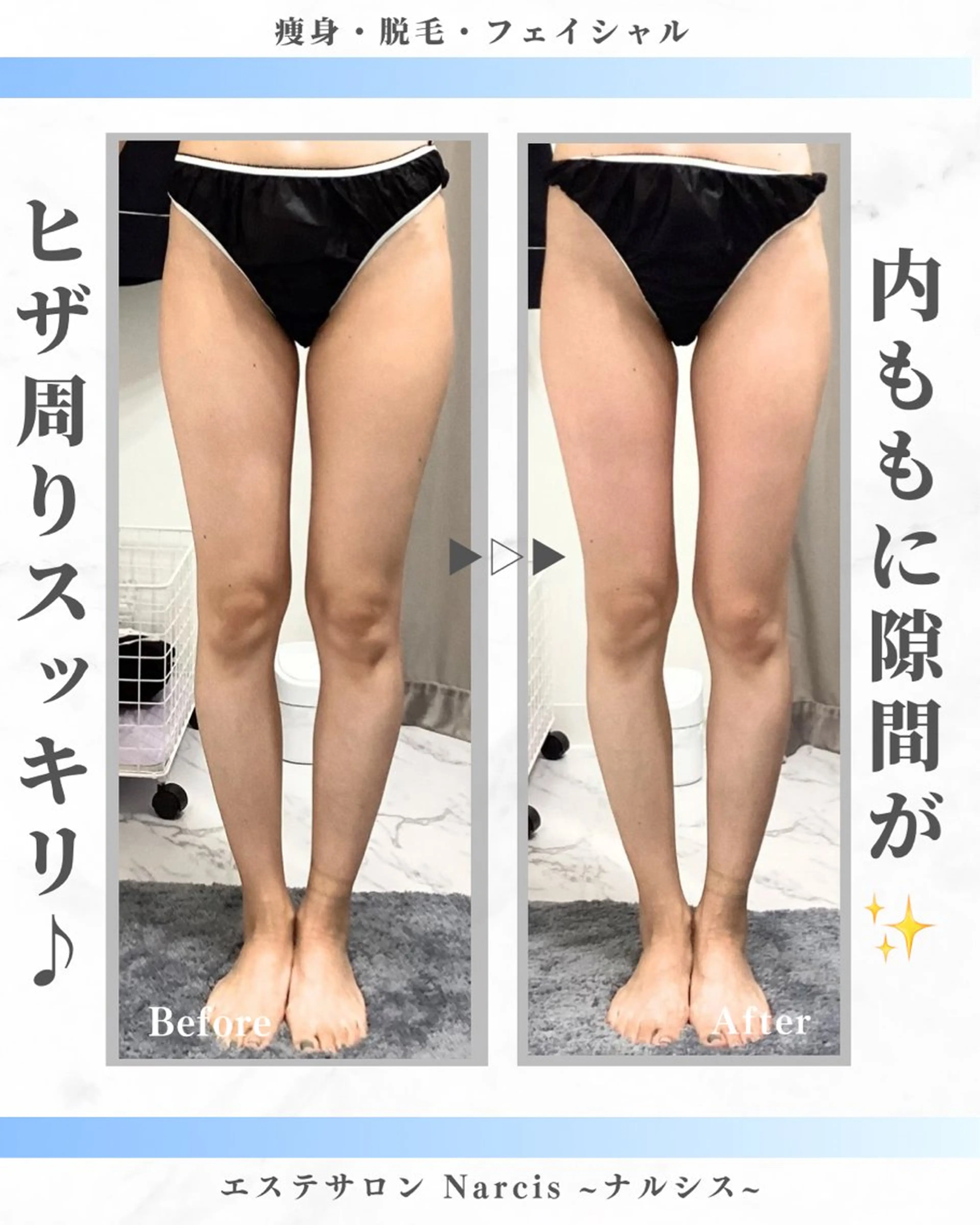 エステサロンNarcis〜ナルシス〜所属・脱毛&痩身エステ Narcisのエステ・リラクイメージ