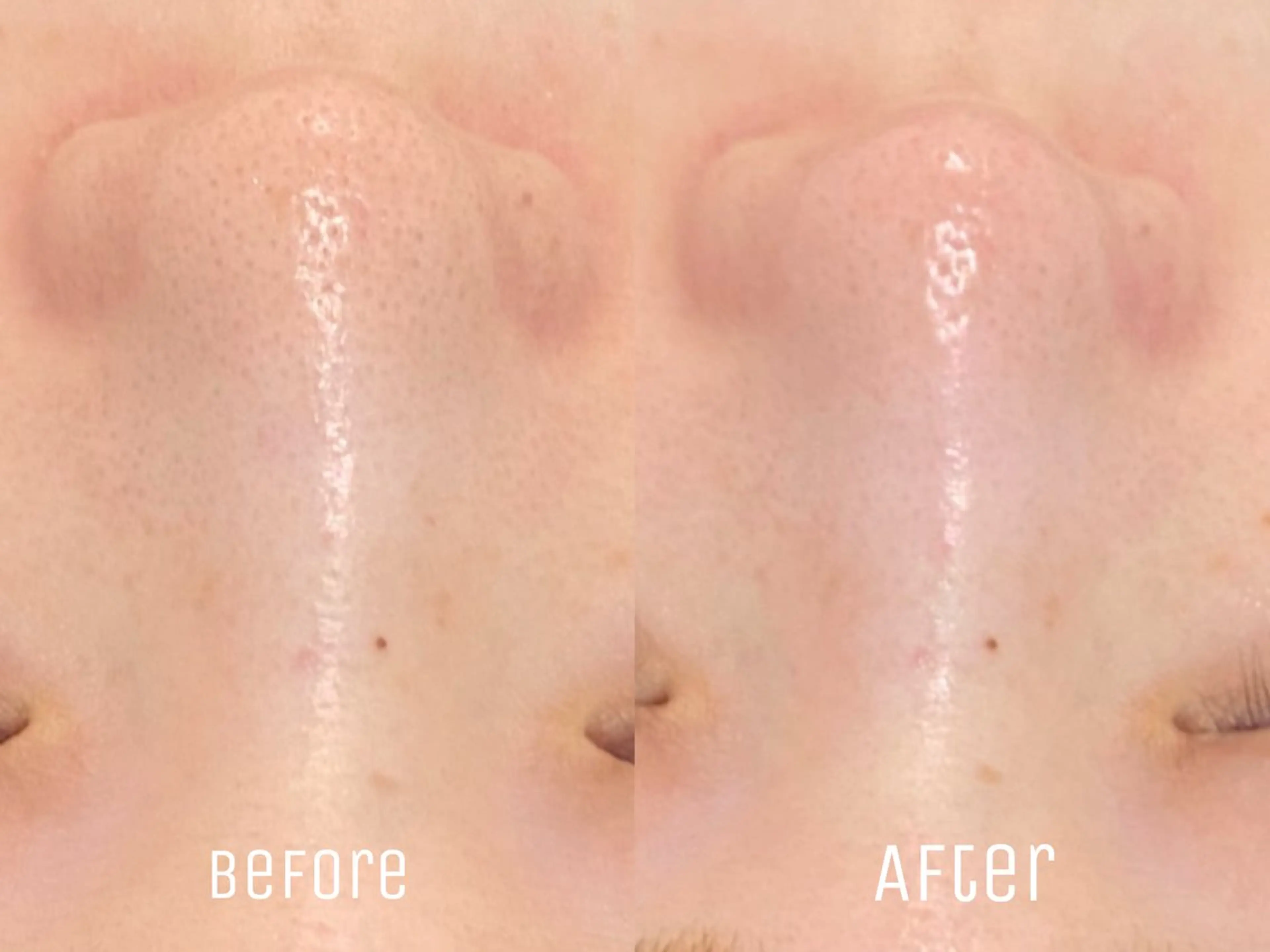 エステ ニキビ・毛穴・肌荒れ &me 西宮北口店のその他イメージ