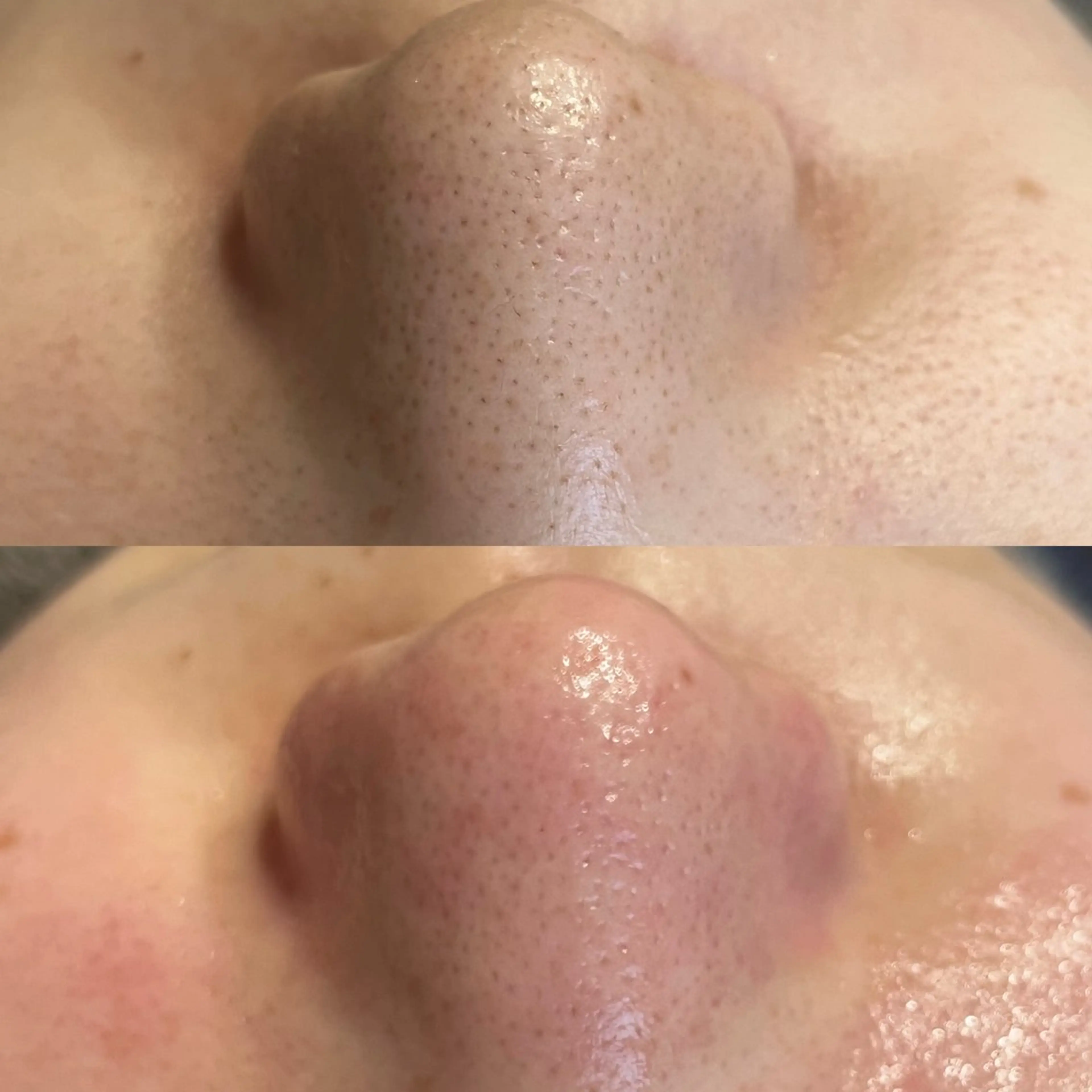 エステ アイラッシュサロン CoCoのマツエク・マツパデザイン