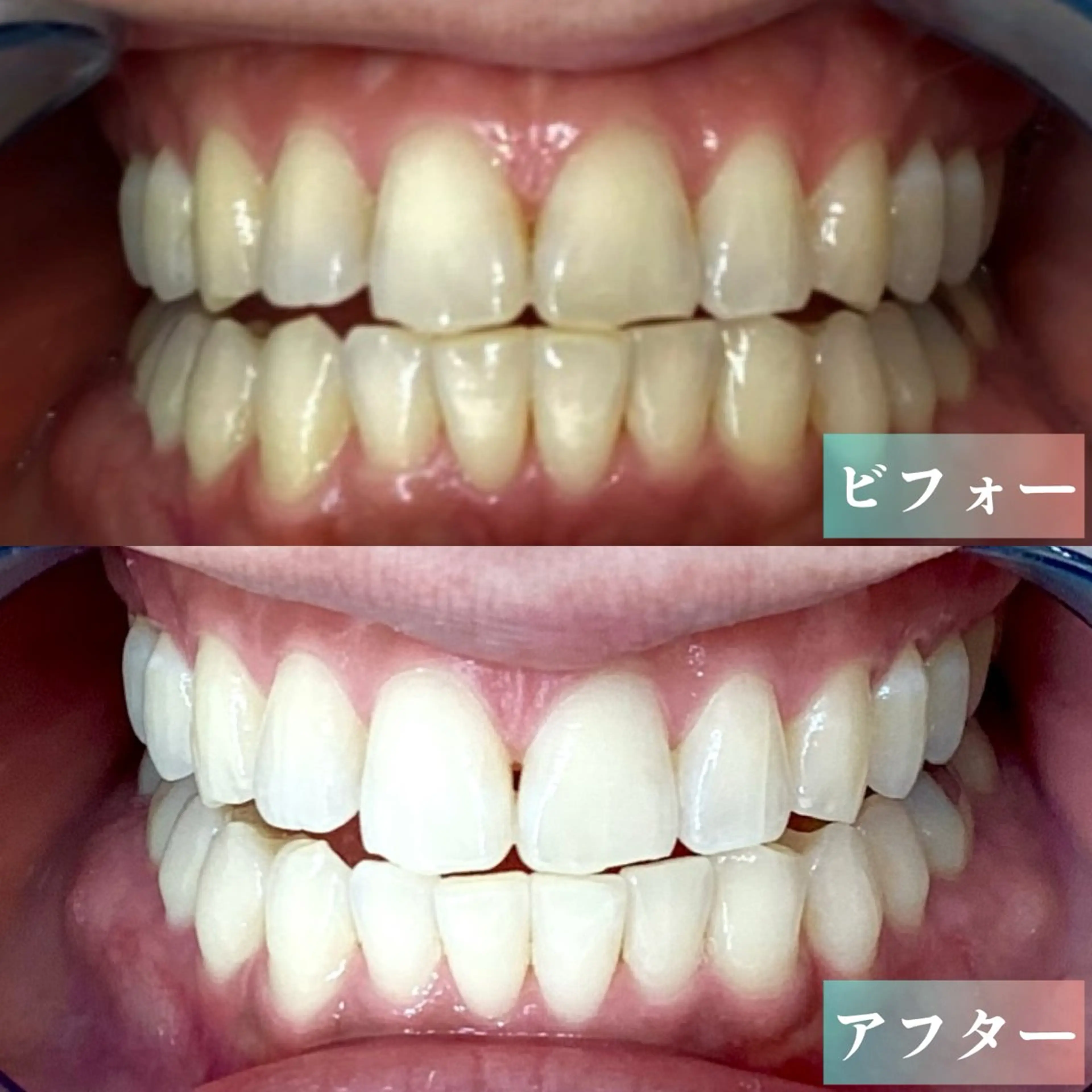 ホワイトニングテラス ティンクルのその他イメージ