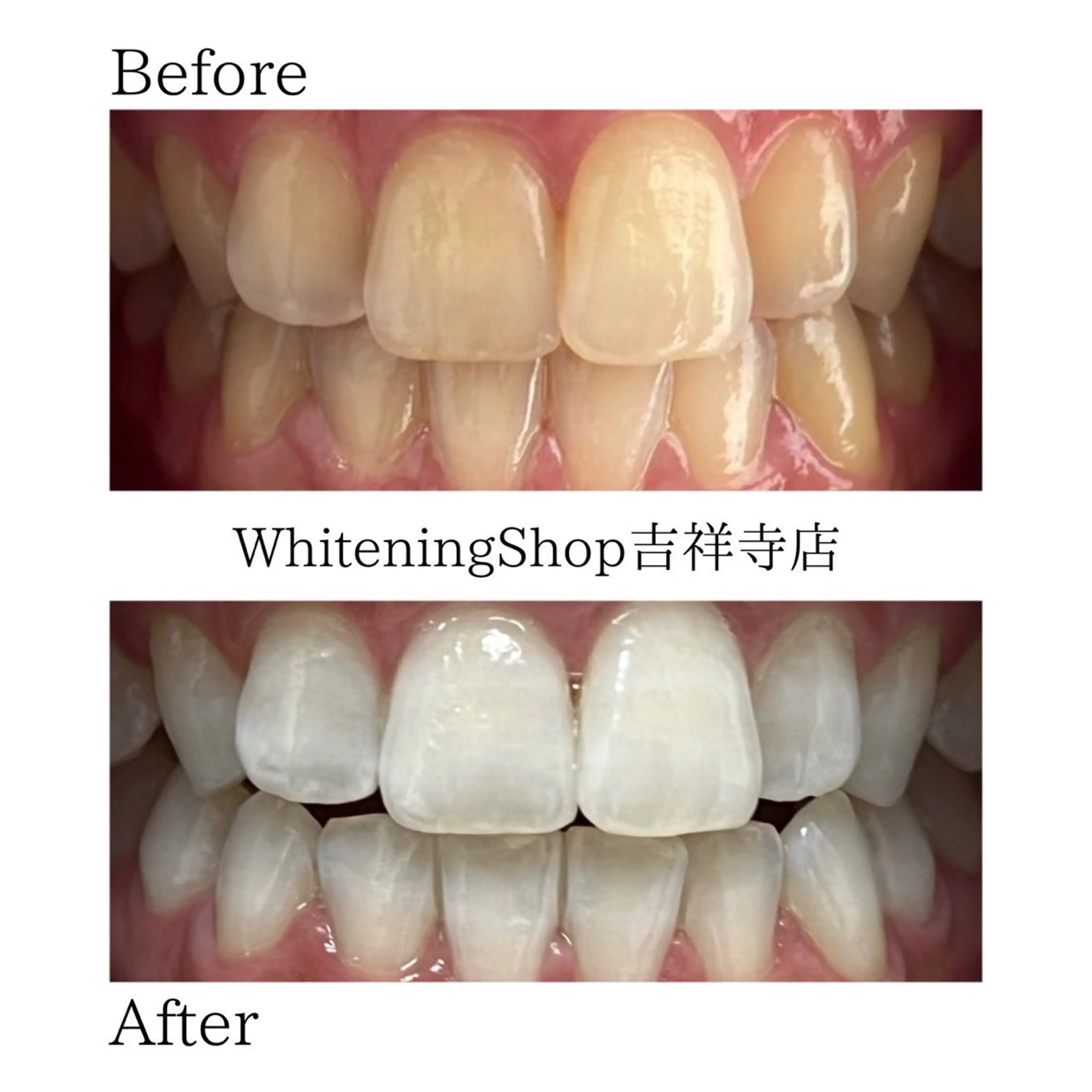 エステ リラク ホワイトニング ショップ吉祥寺店のエステ・リラクイメージ