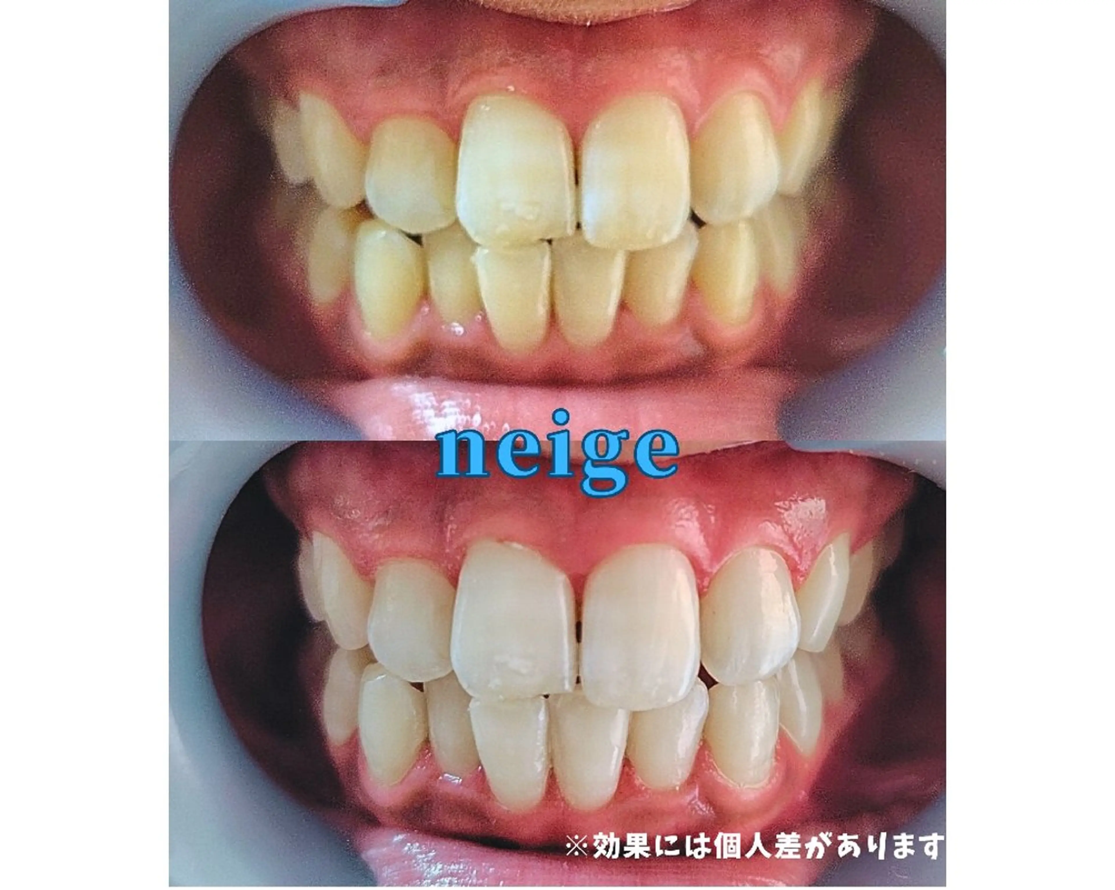 ホワイトニングサロン ネージュ(女性専用)のその他イメージ