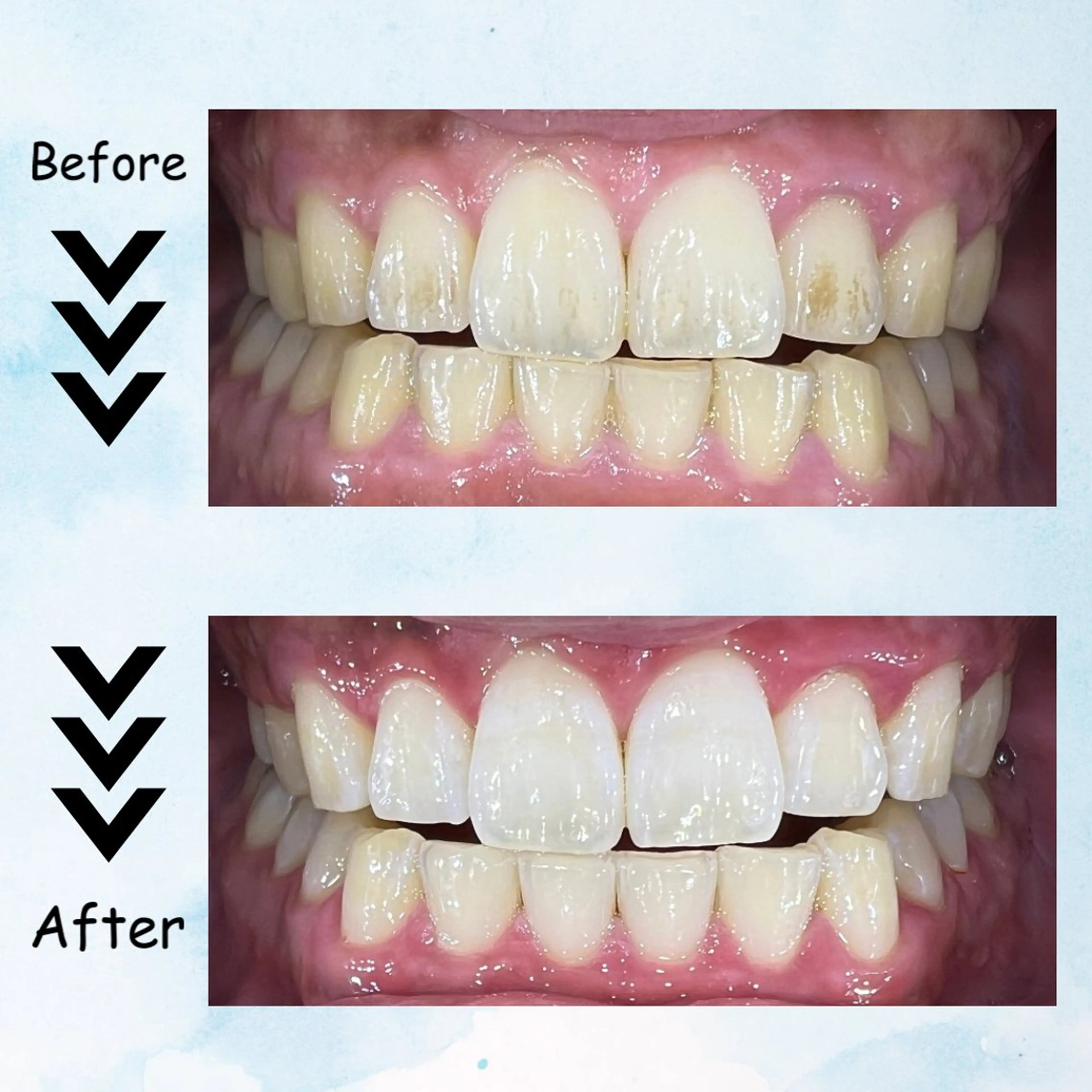 メンズ その他 セルフホワイトニング エクシア塩釜口駅前店所属・セルフホワイトニング エクシア塩釜口駅前店のその他イメージ