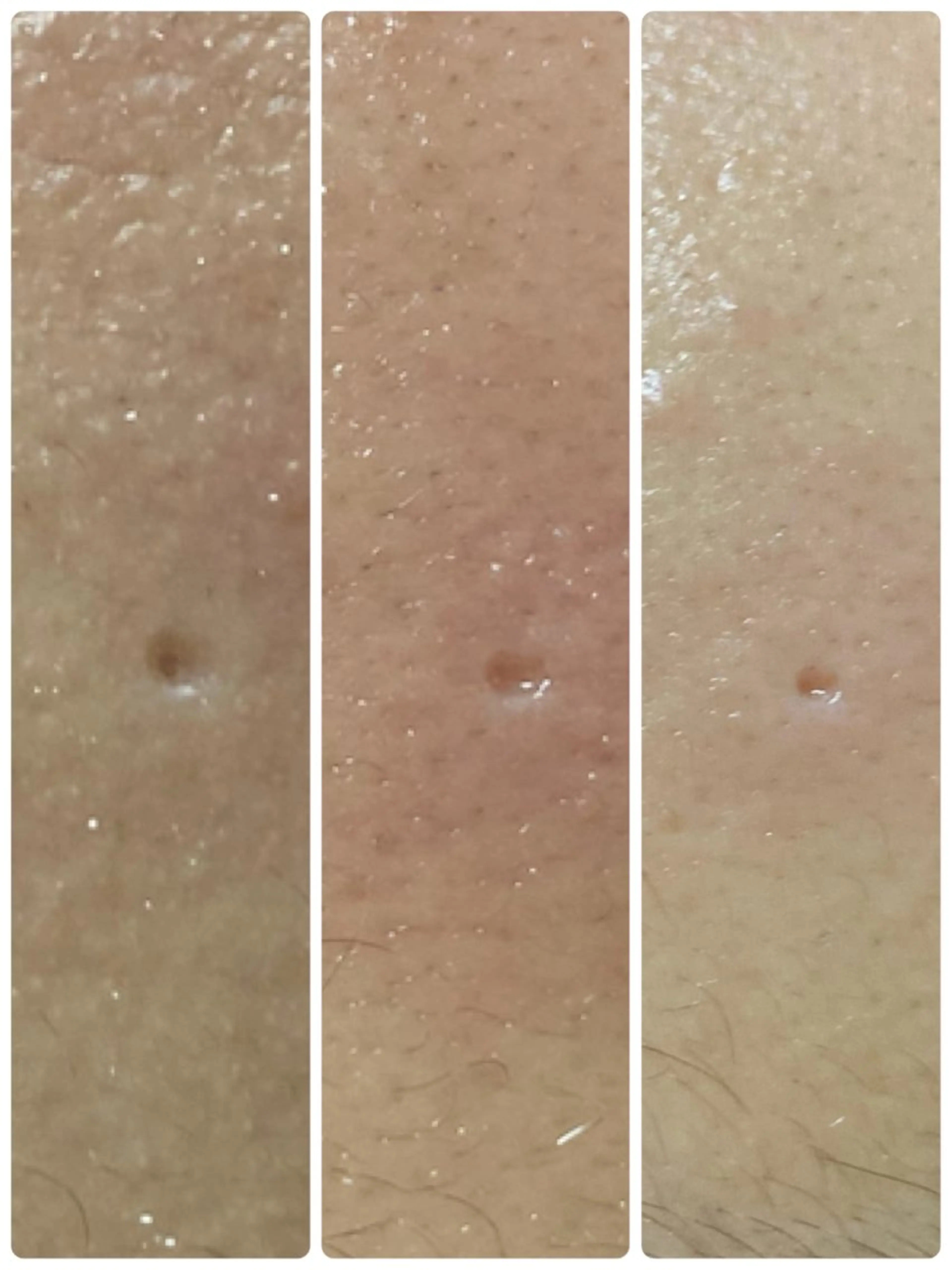 エステ トータルエステサロン Tiaraのエステ・リラクイメージ