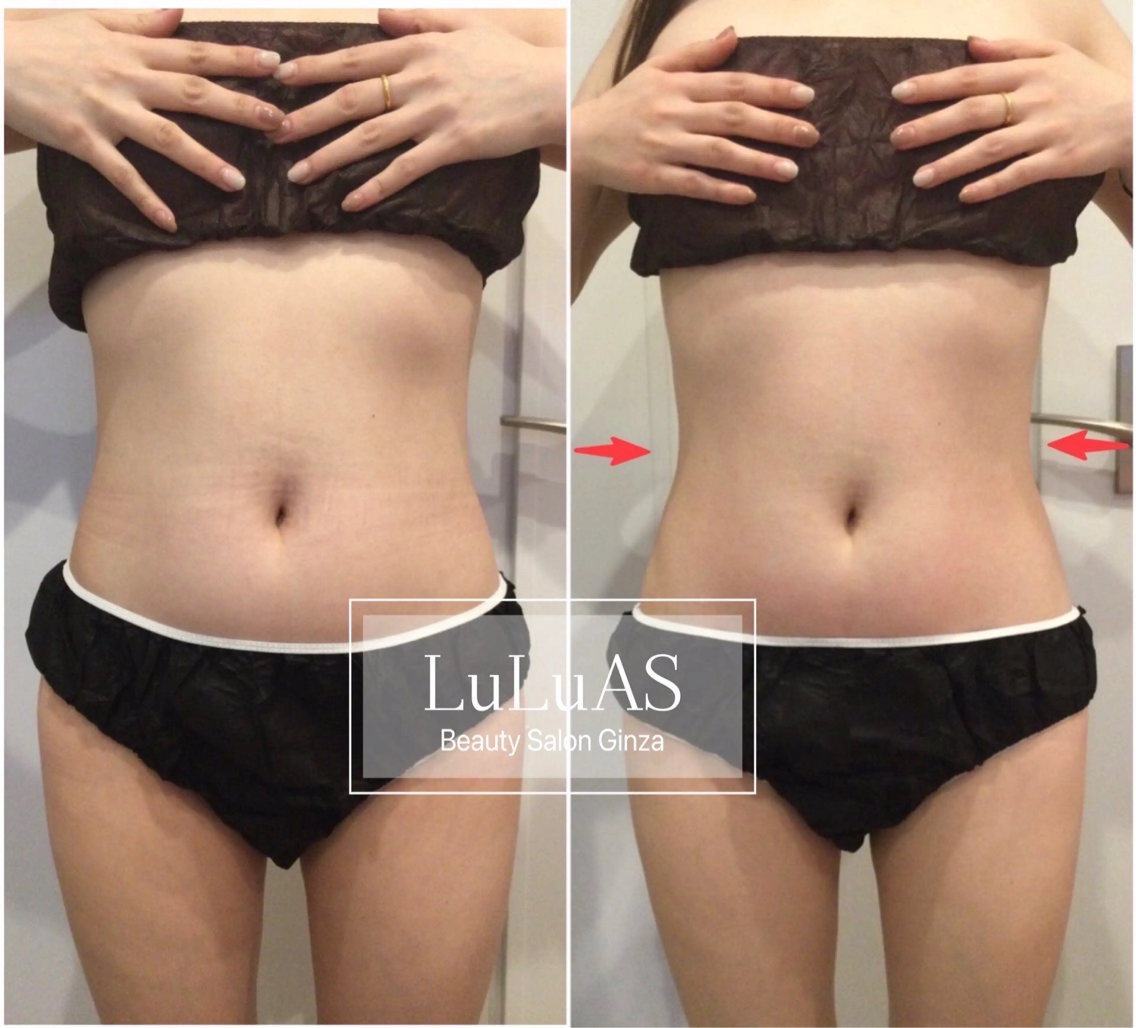 【4周年特価キャンペーン🉐】本格痩身×選べるフェイシャル120分の写真