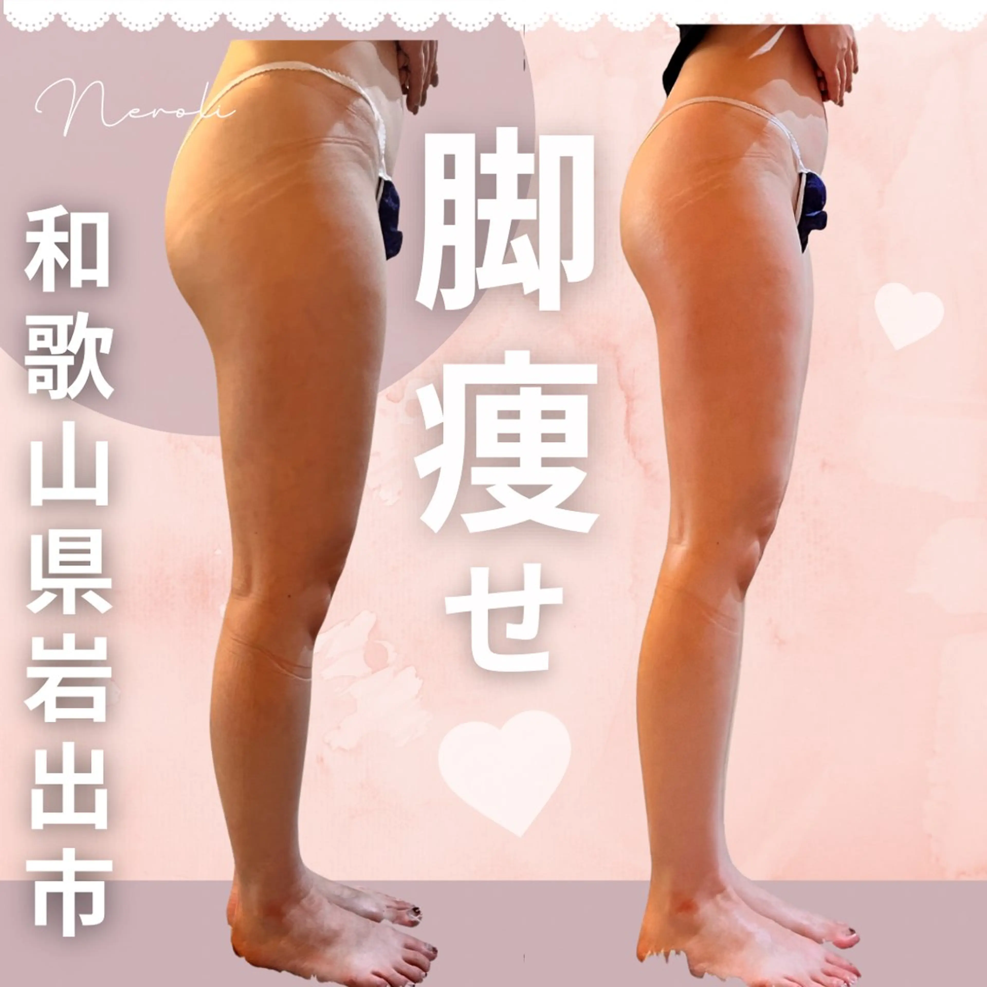 エステ 温活beautyサロンNeroli所属・切らない脂肪吸引🔥 Neroliまりこのエステ・リラクイメージ