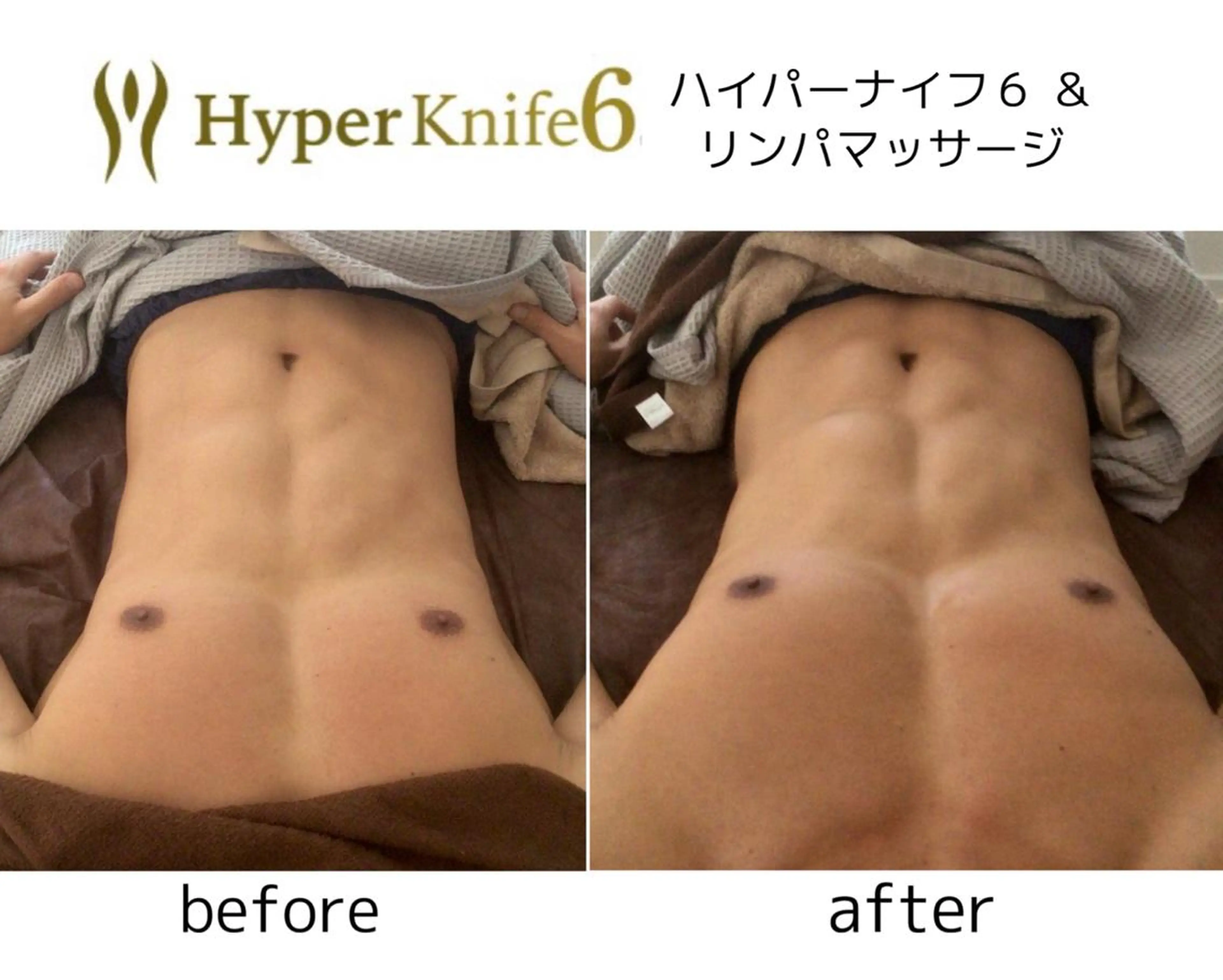 痩身サロンiBDY所属・いわきり ゆきのエステ・リラクイメージ