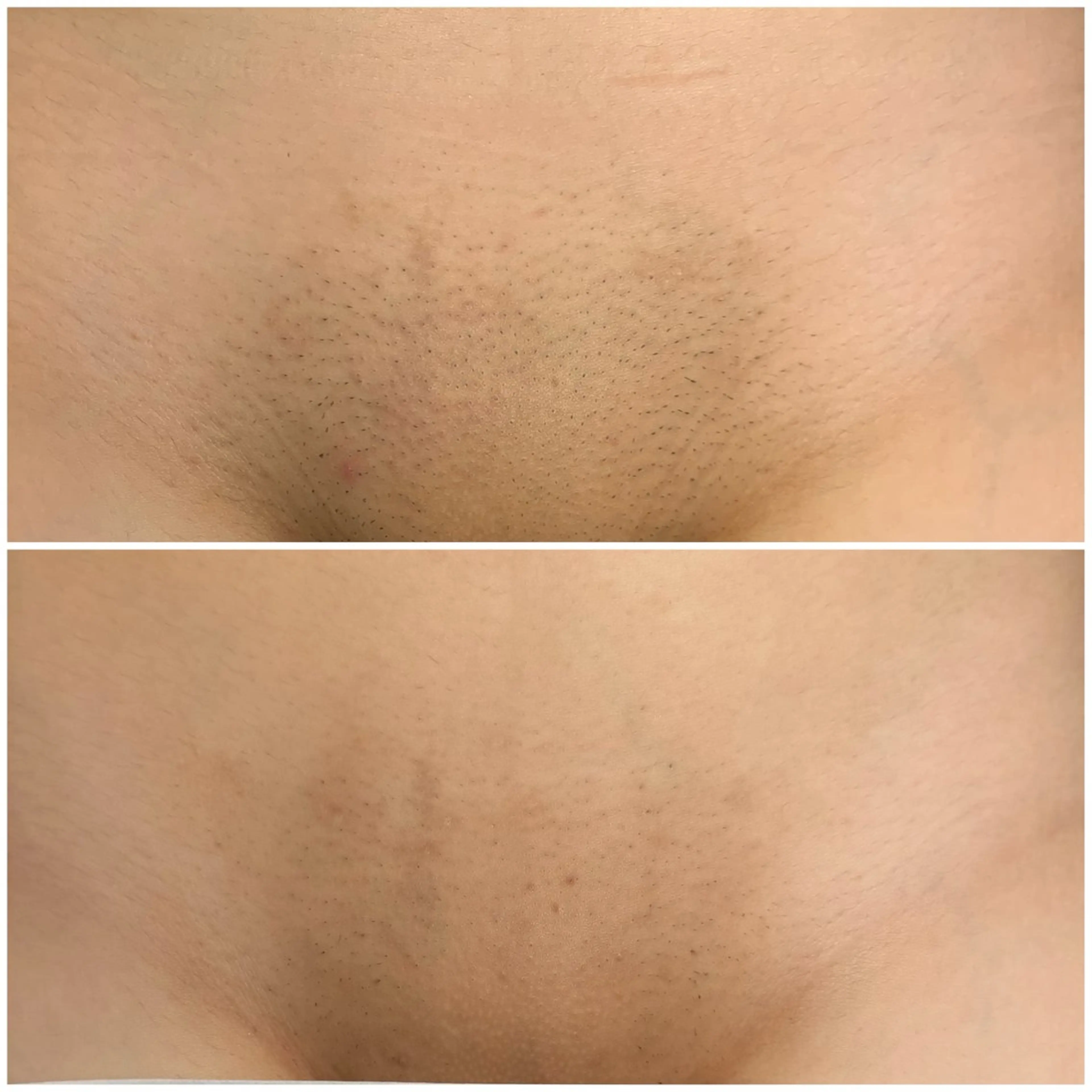 脱毛 Moki Amandaのエステ・リラクイメージ