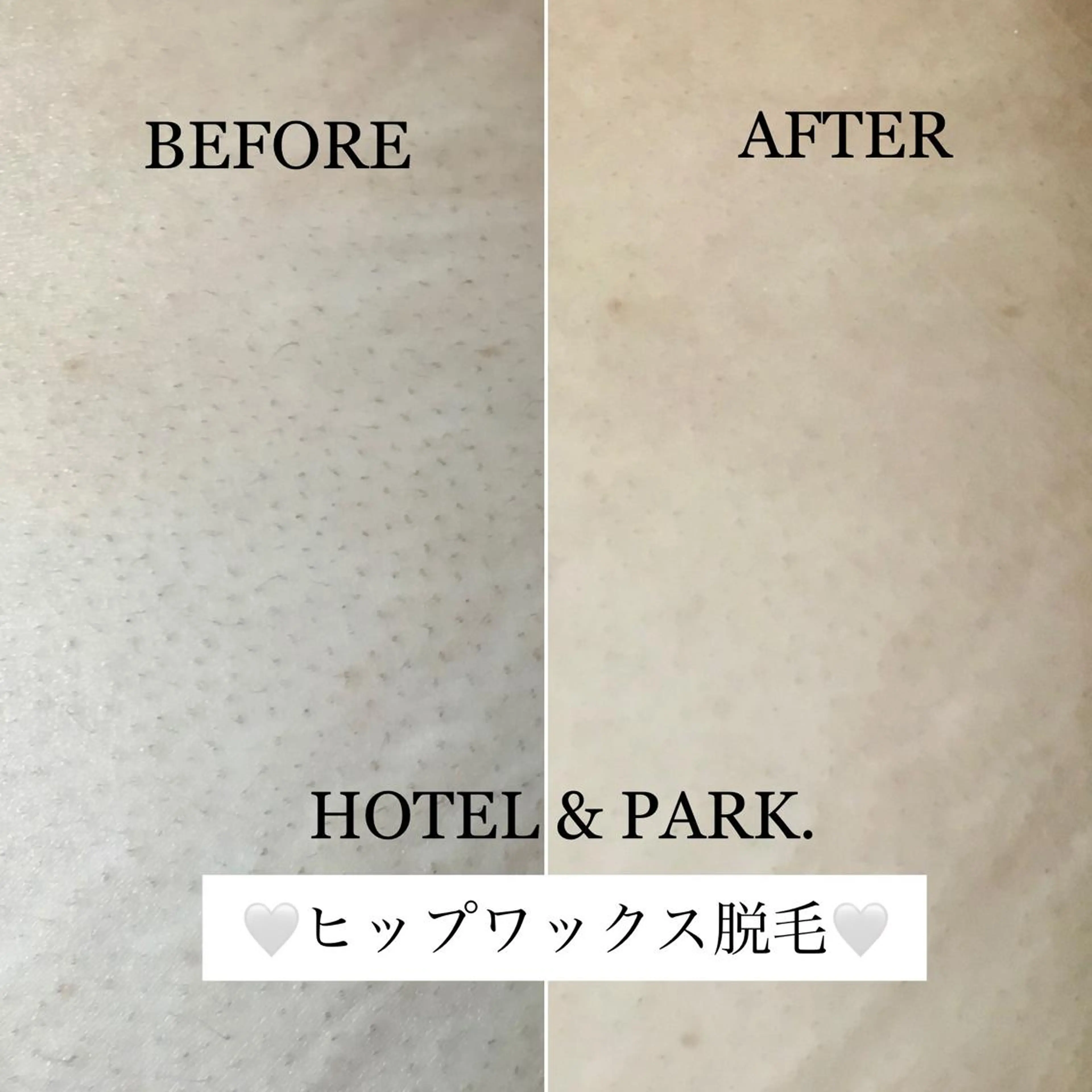 HOTEL&PARK . ワックス脱毛のエステ・リラクイメージ
