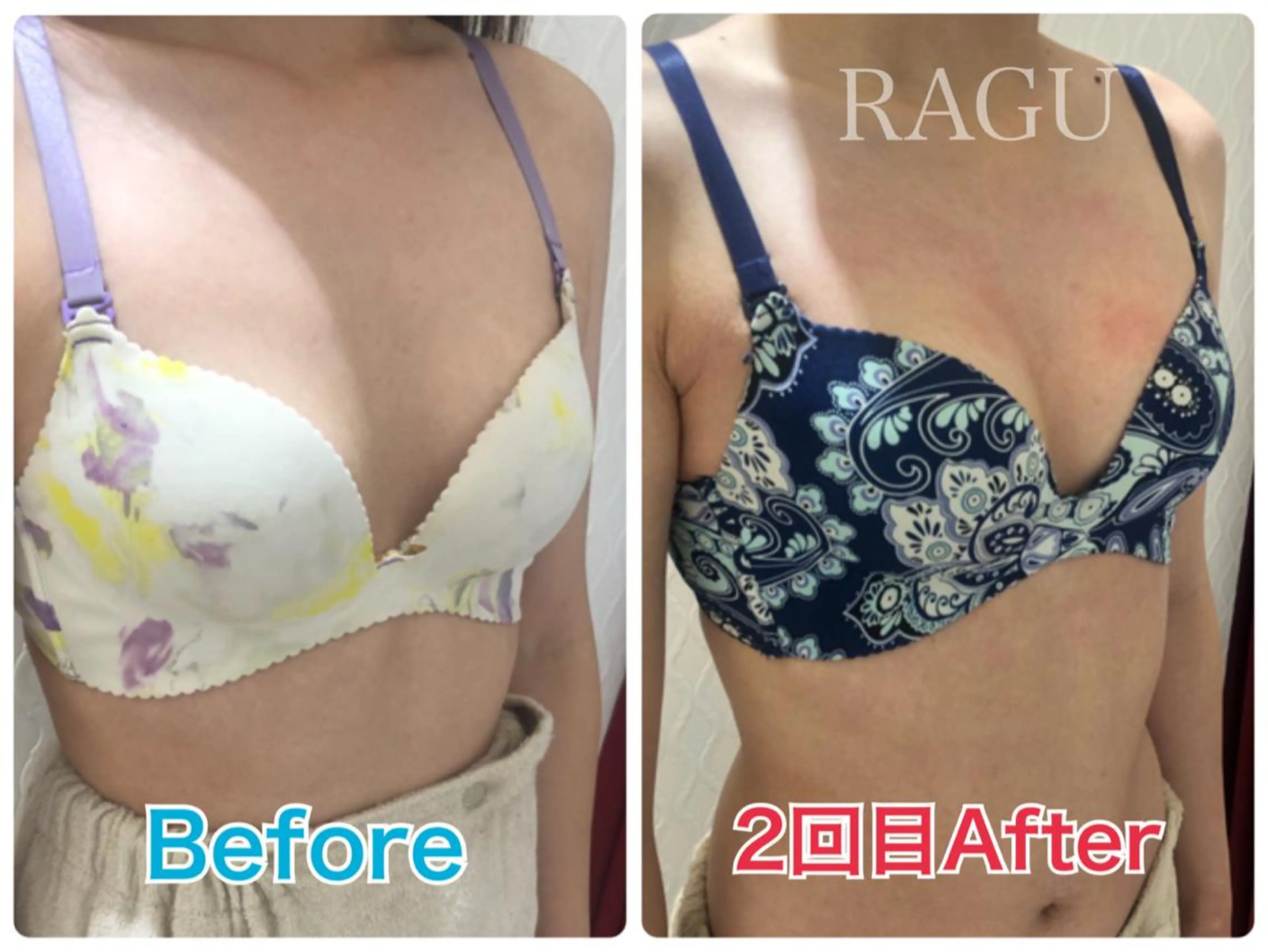 エステ RAGU BEAUTY所属・原口 彩子のエステ・リラクイメージ