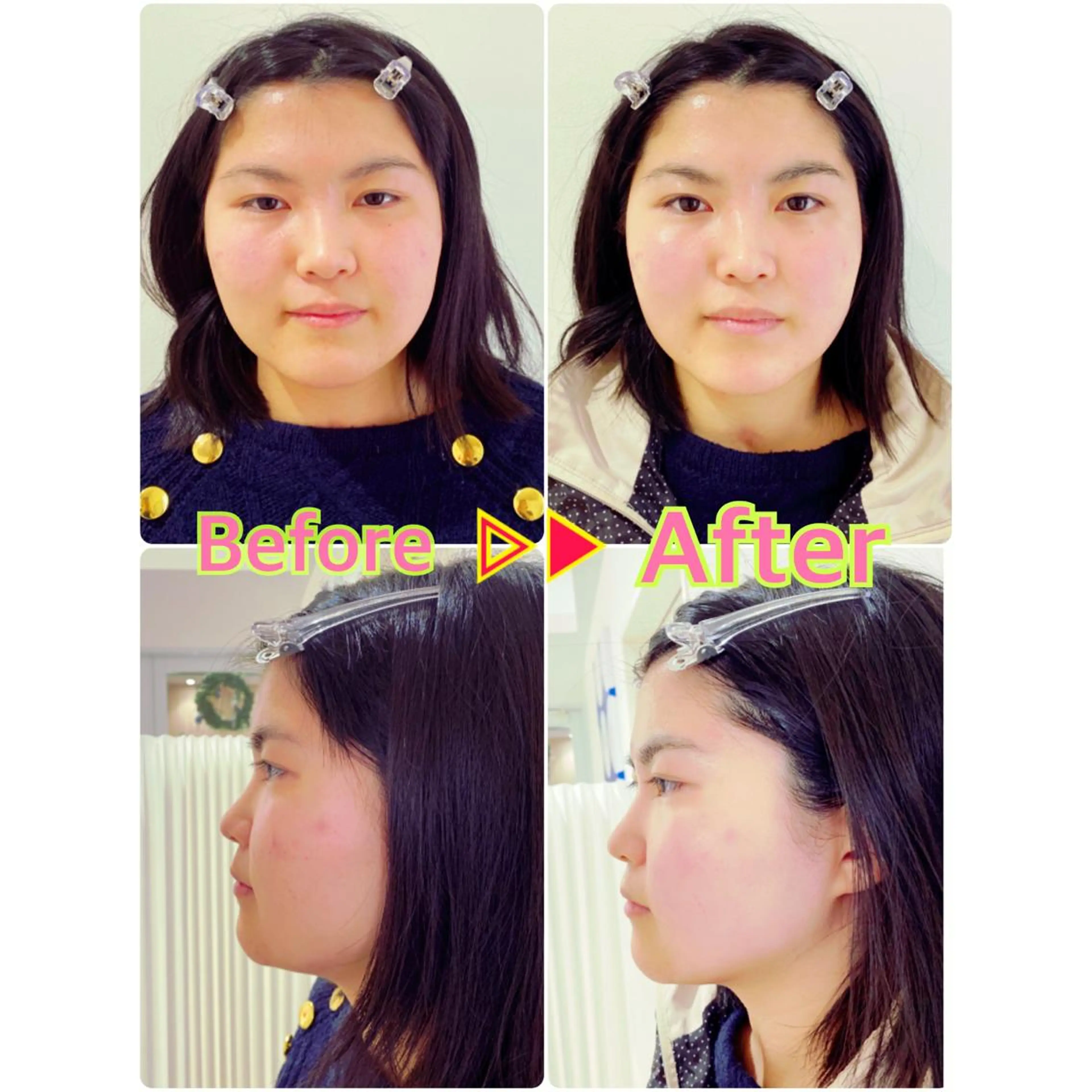 エステ リラク ポーラ 四日市 日永カヨー店所属・ポーラ 四日市カヨー店のエステ・リラクイメージ