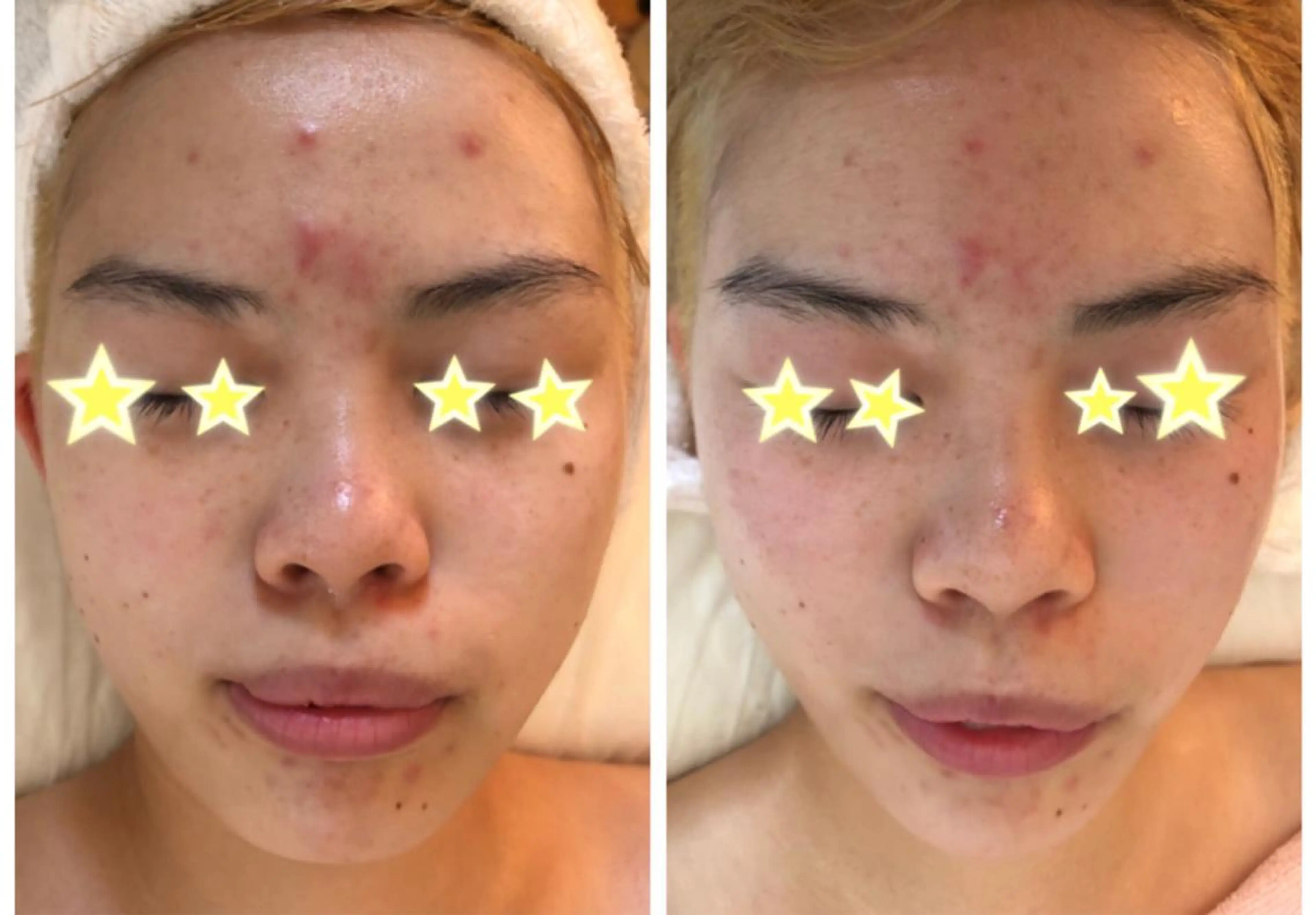 エステ メナードフェイシャルサロン西区天塚所属・平岩 仁美のエステ・リラクイメージ