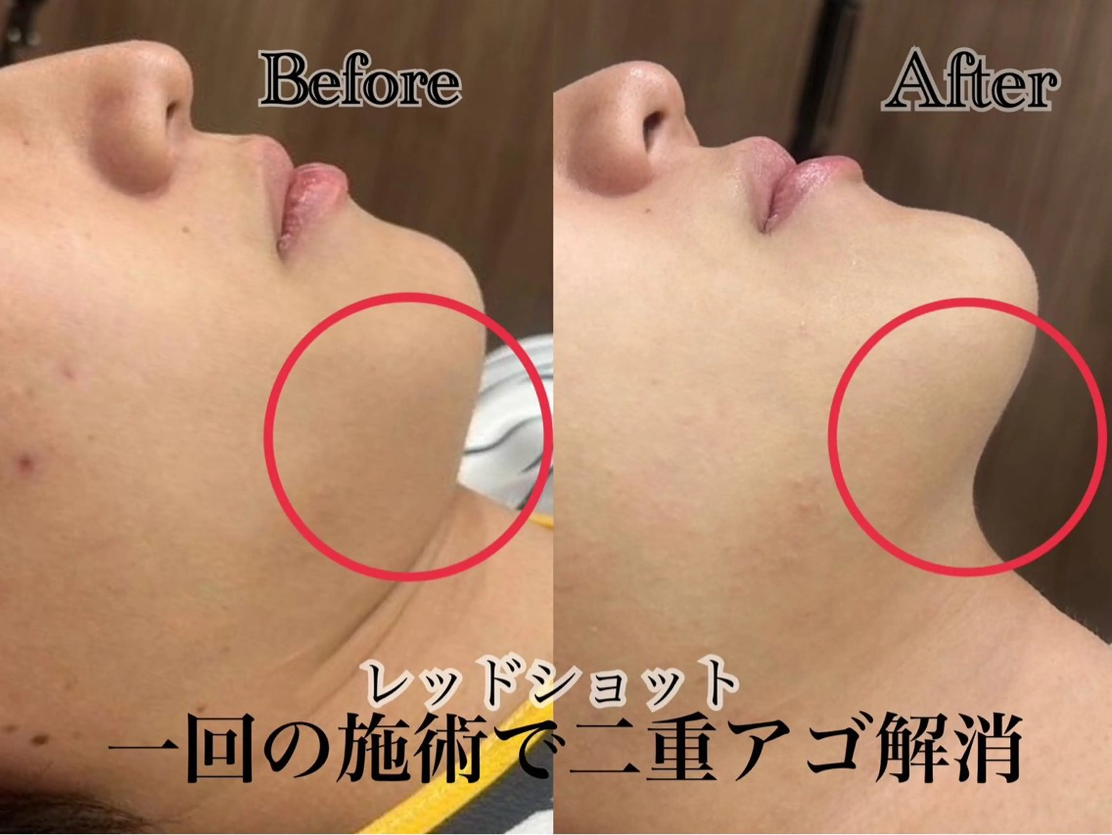 六本木脱毛andS さおりのエステ・リラクイメージ