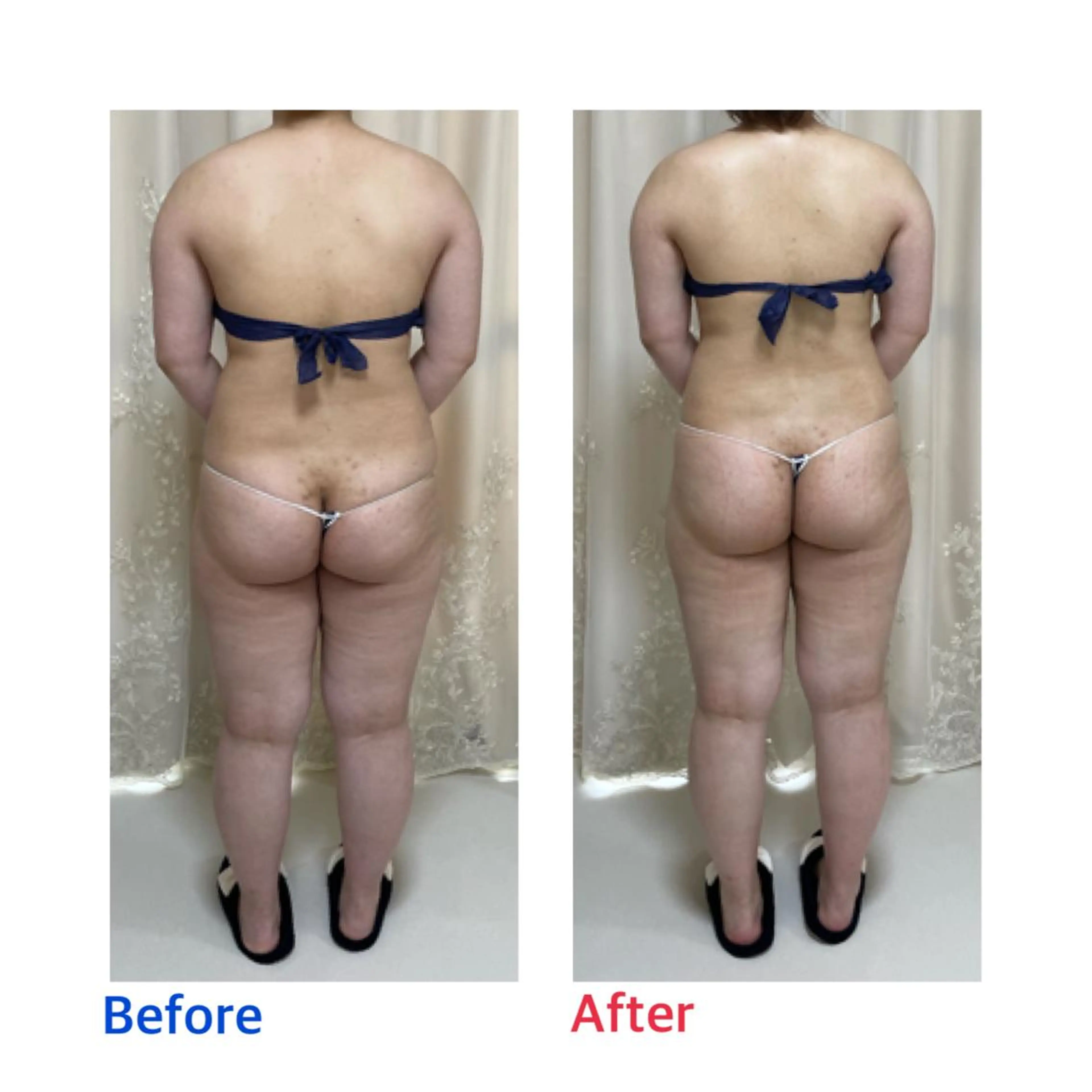 エステ リラク プライベートサロンmoyo所属・プライベートサロン moyoのエステ・リラクイメージ