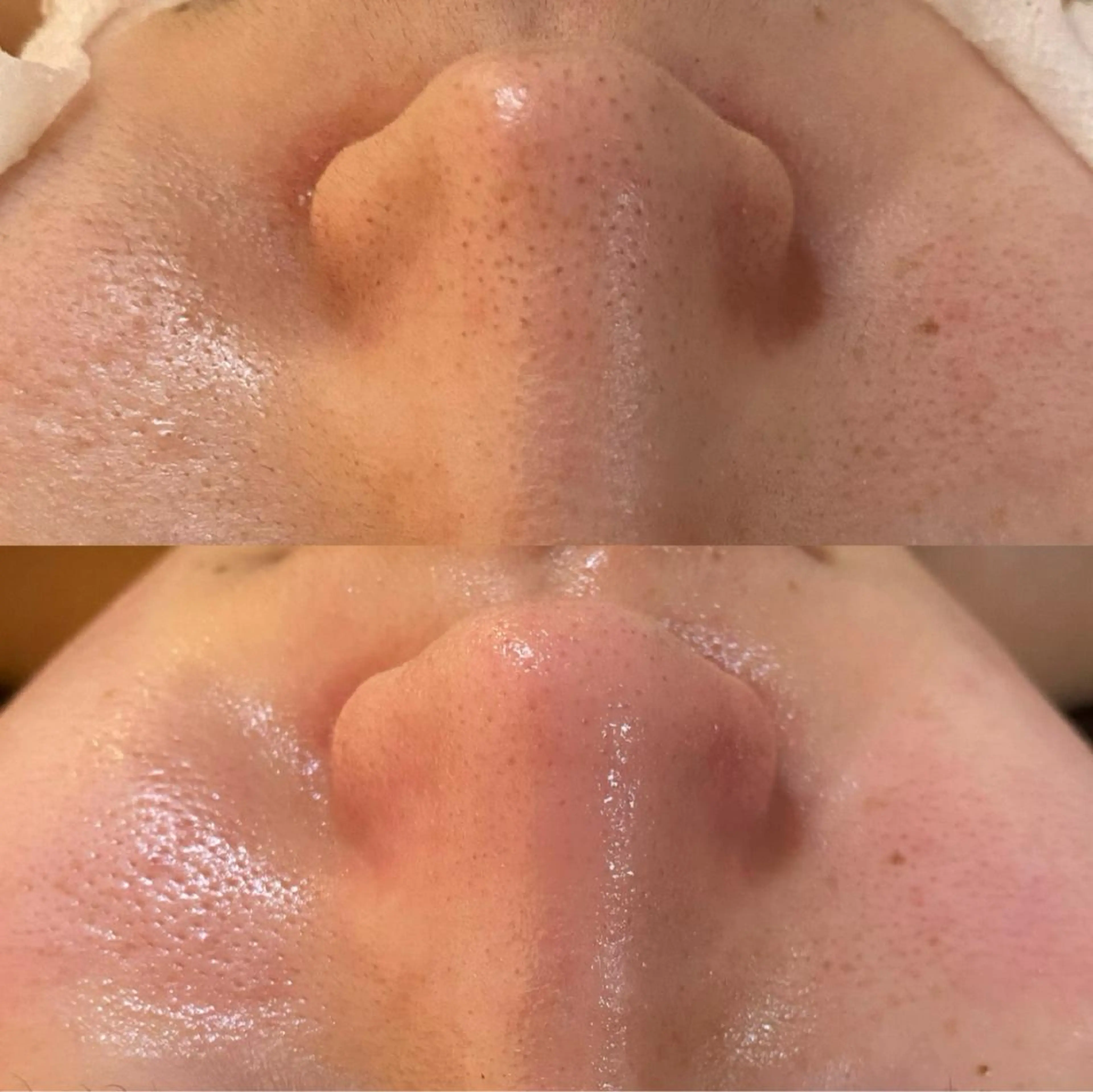 エステ リラク BELCIA福岡店　récolte de BELCIA（レコルトデベルシア）所属・BELCIA福岡店 レコルトデベルシアのエステ・リラクイメージ