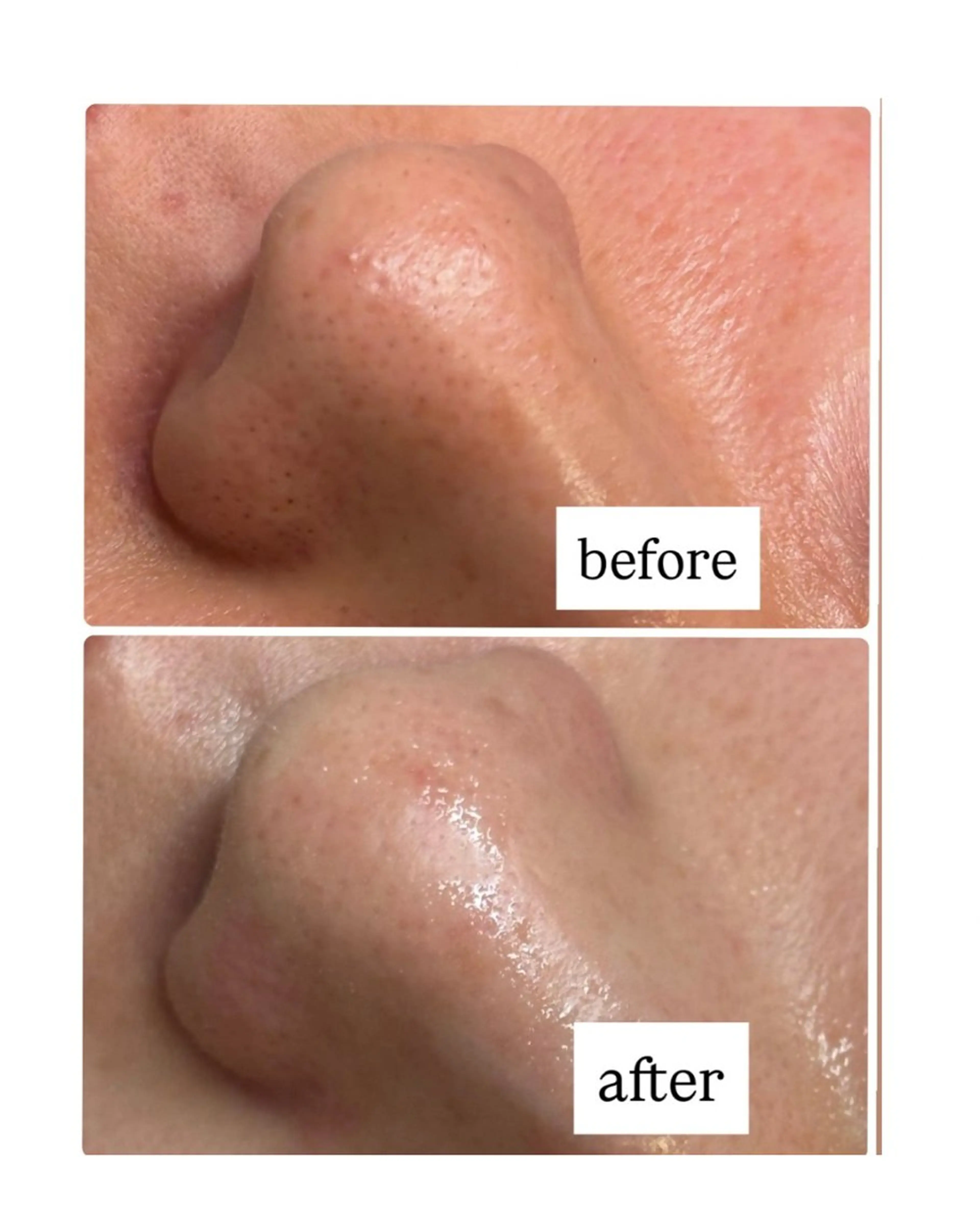 その他 Salon【yuzu.】所属・🍊肌管理×美眉 【yuzu.】の眉毛・アイブロウイメージ