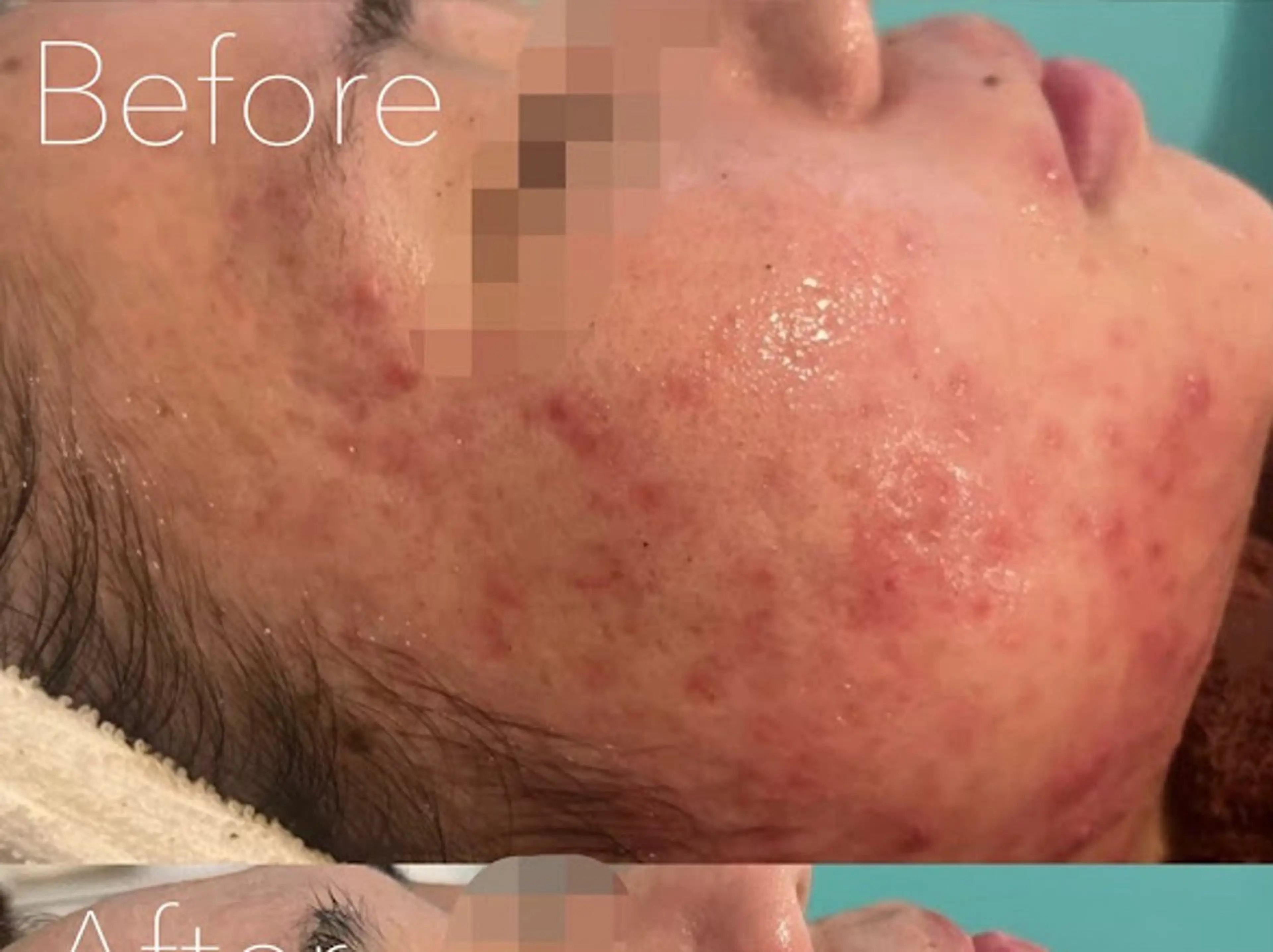 エステ 韓国肌管理Belle 神戸元町のエステ・リラクイメージ