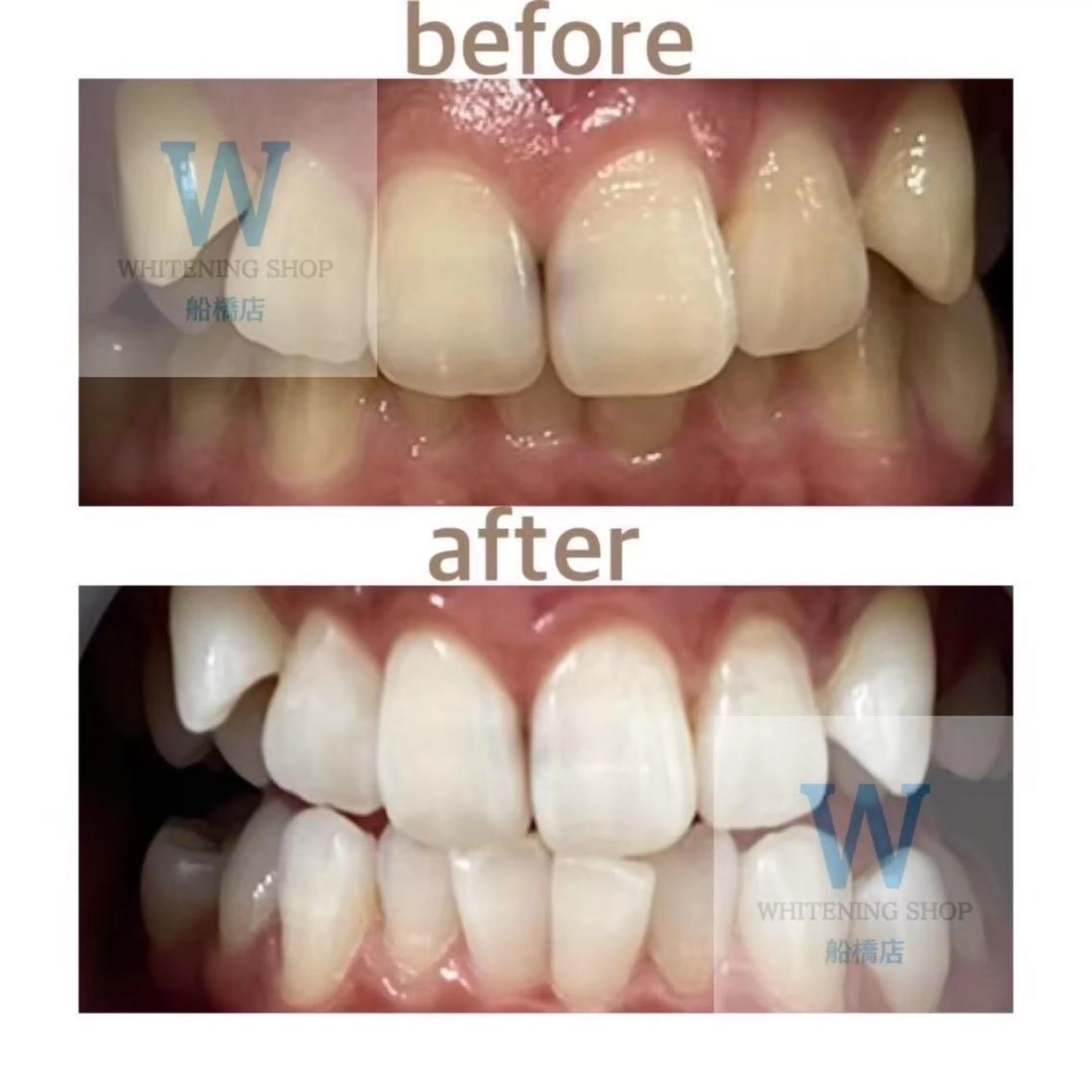 エステ リラク ホワイトニング ショップ船橋店🦷のエステ・リラクイメージ