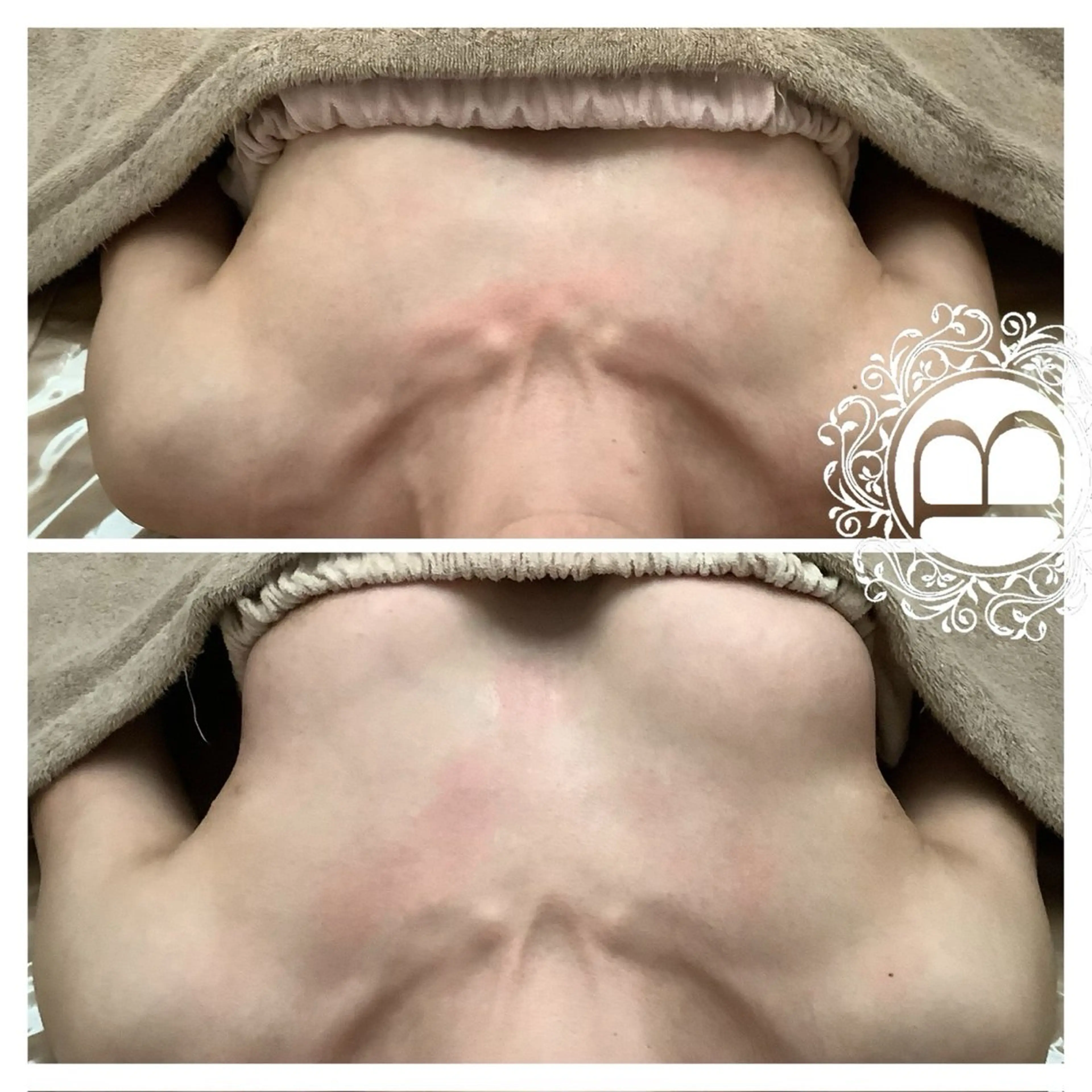 エステ リラク ミラクルバスト銀座本店所属・ミラクルバスト 銀座店のエステ・リラクイメージ