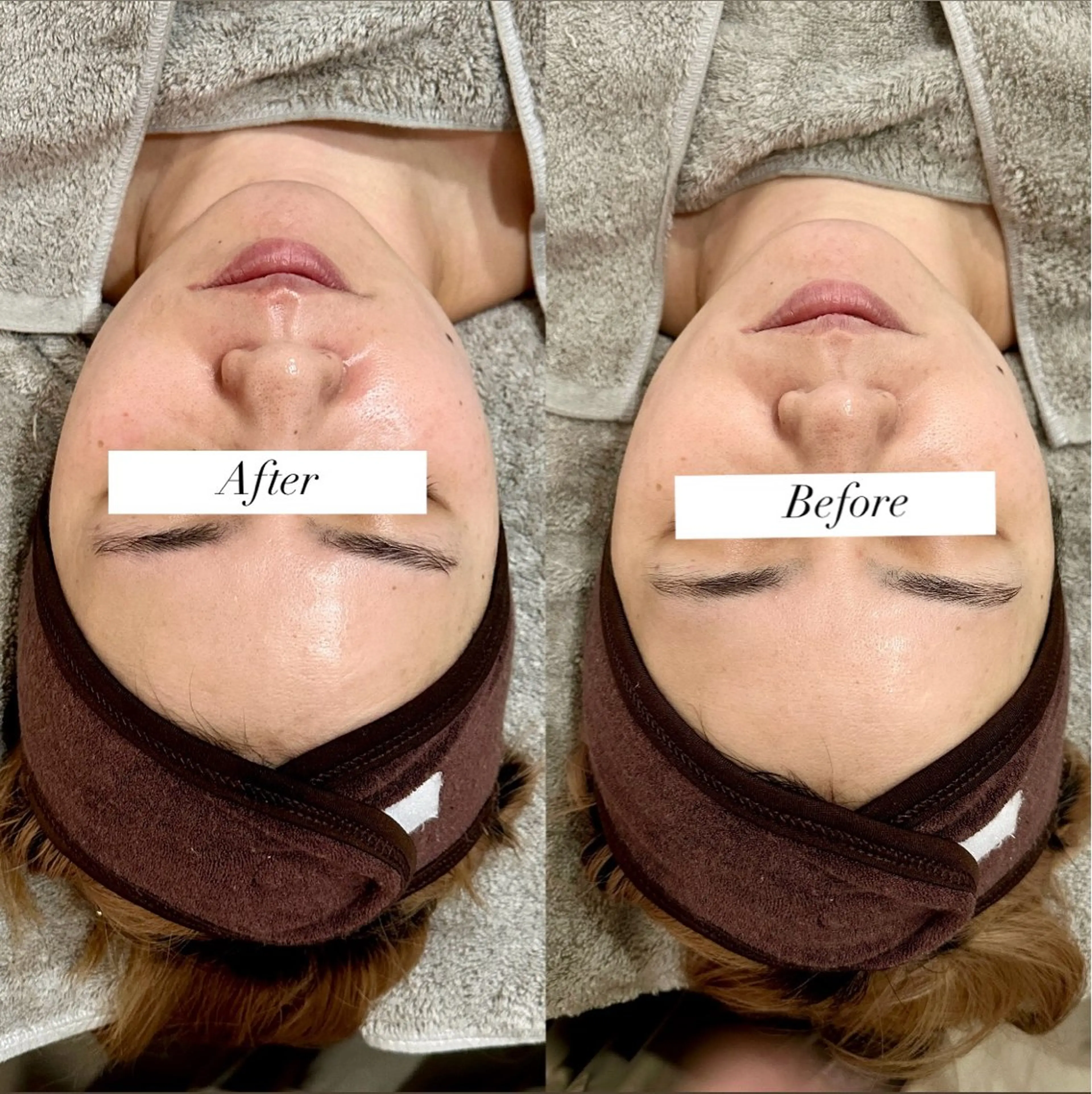 エステ lafleur Yurinaのエステ・リラクイメージ