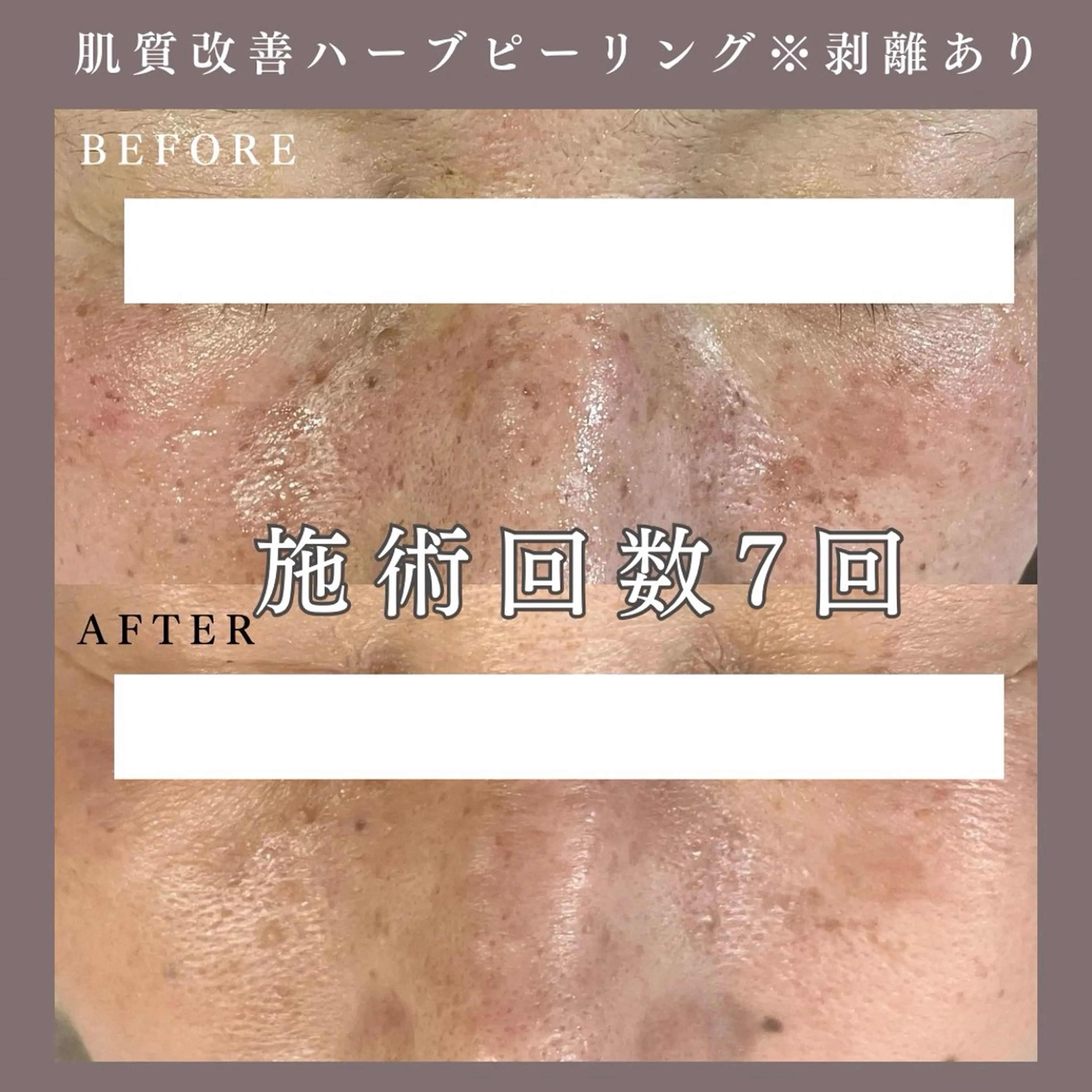 エステ 肌質改善専門サロン Bellmi/心斎橋のエステ・リラクイメージ