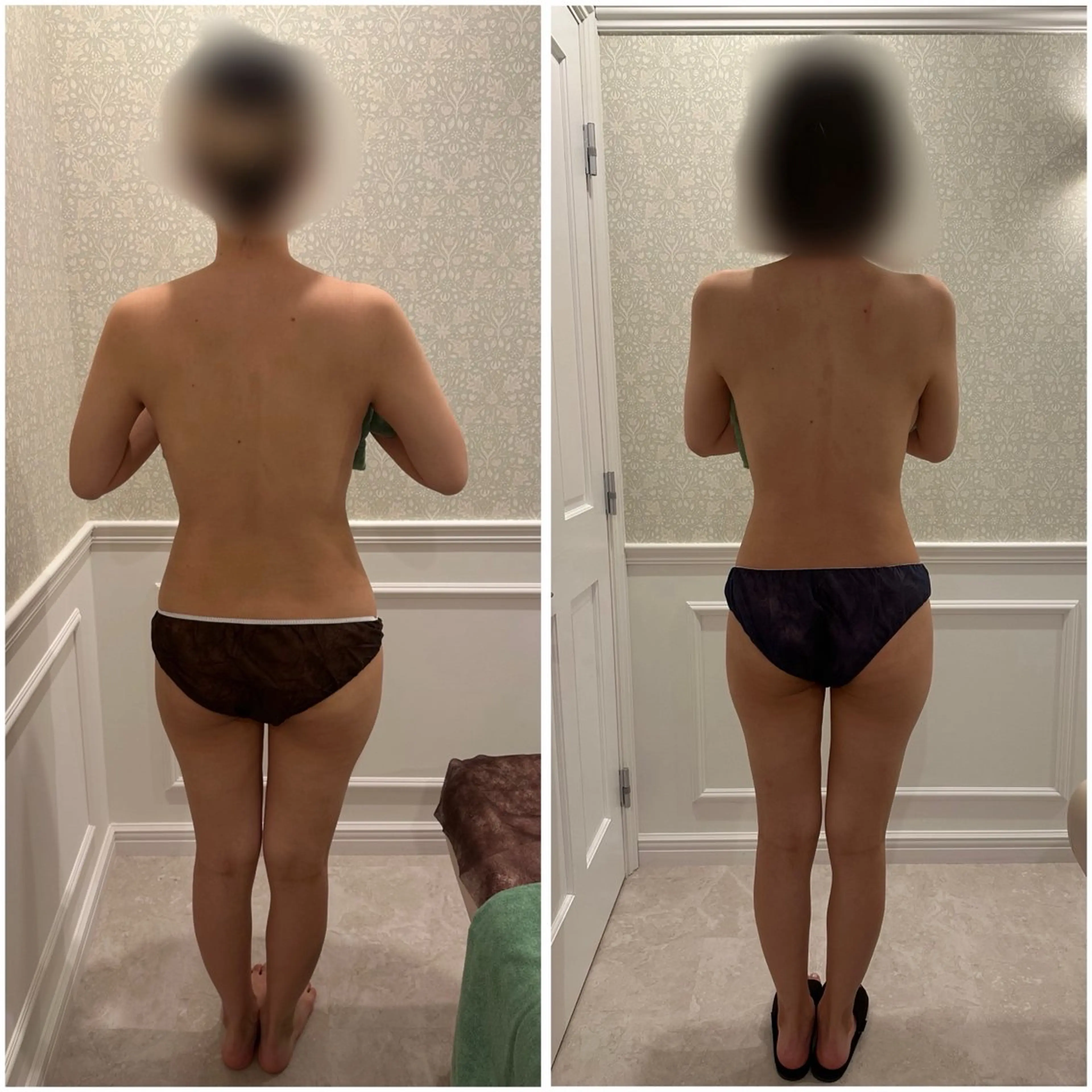 🉐エステ×整体×ツボ経絡の技✨️骨格矯正オイルトリートメント60分☘【全身むくみ撃退】【O脚、巻き肩、反り腰改善】の写真