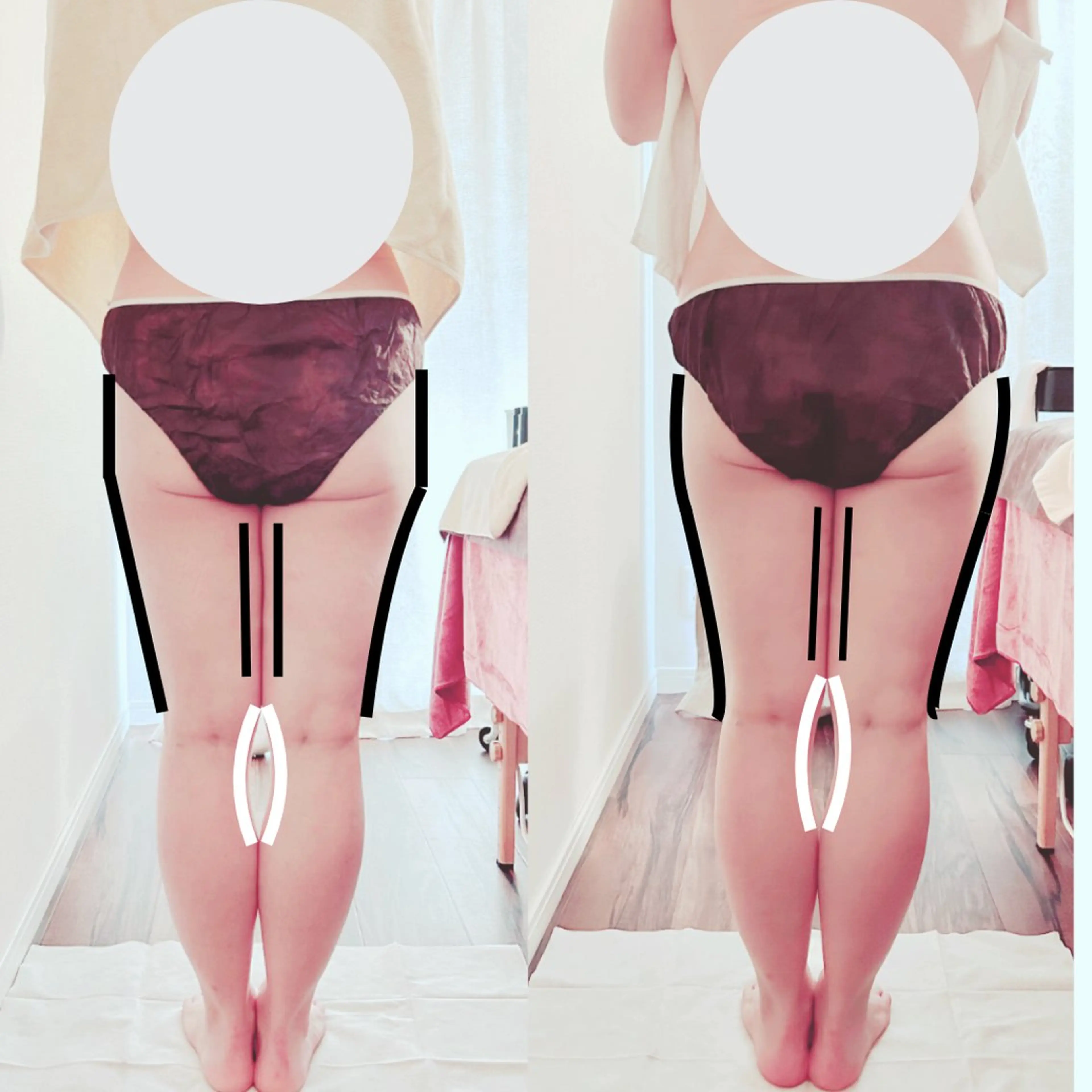 脚痩せ&ヒップアップ 専門サロン|さくらのエステ・リラクイメージ