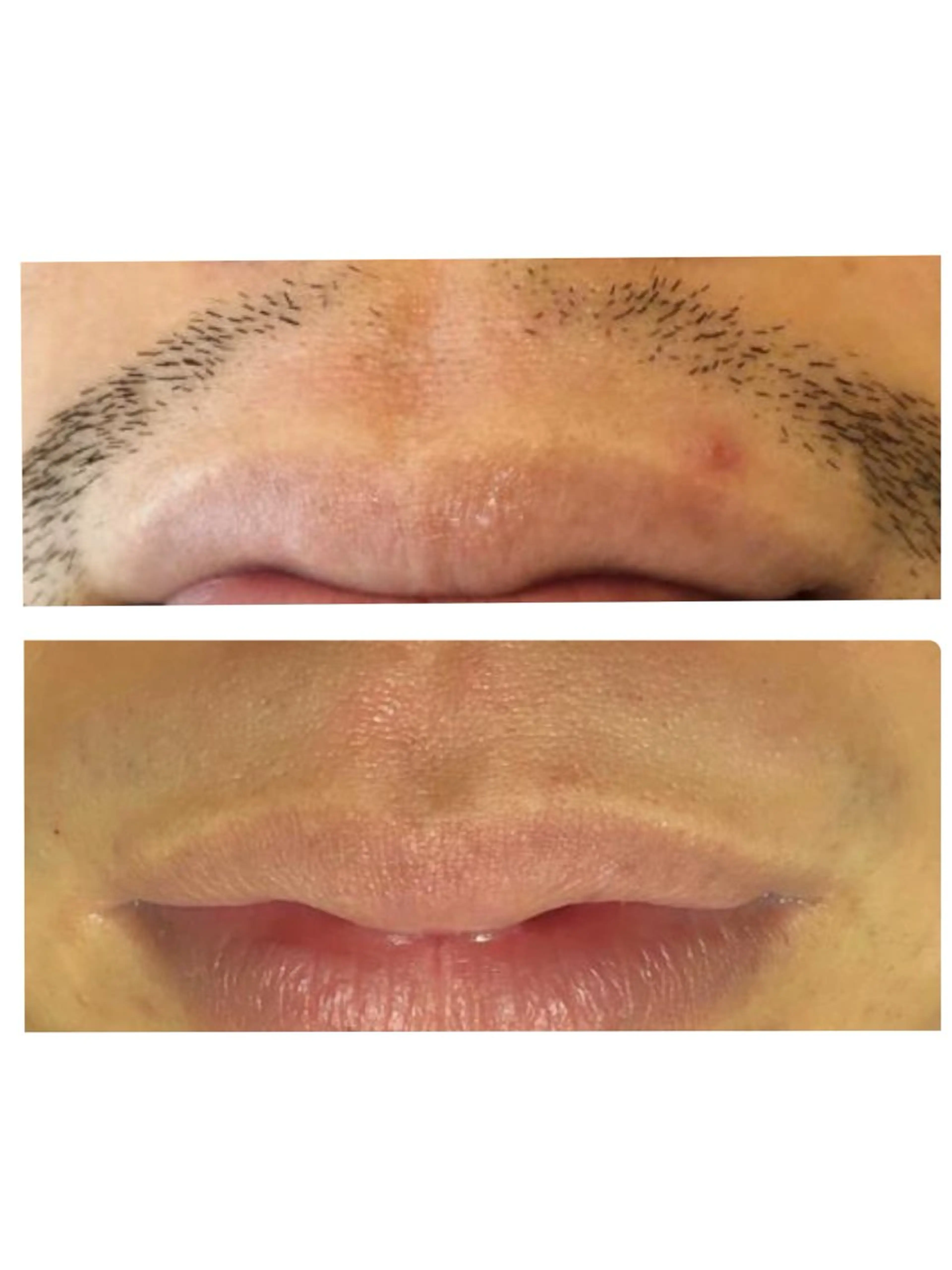 メンズ 脱毛 sourire麻布十番店所属・sourire スリールのエステ・リラクイメージ