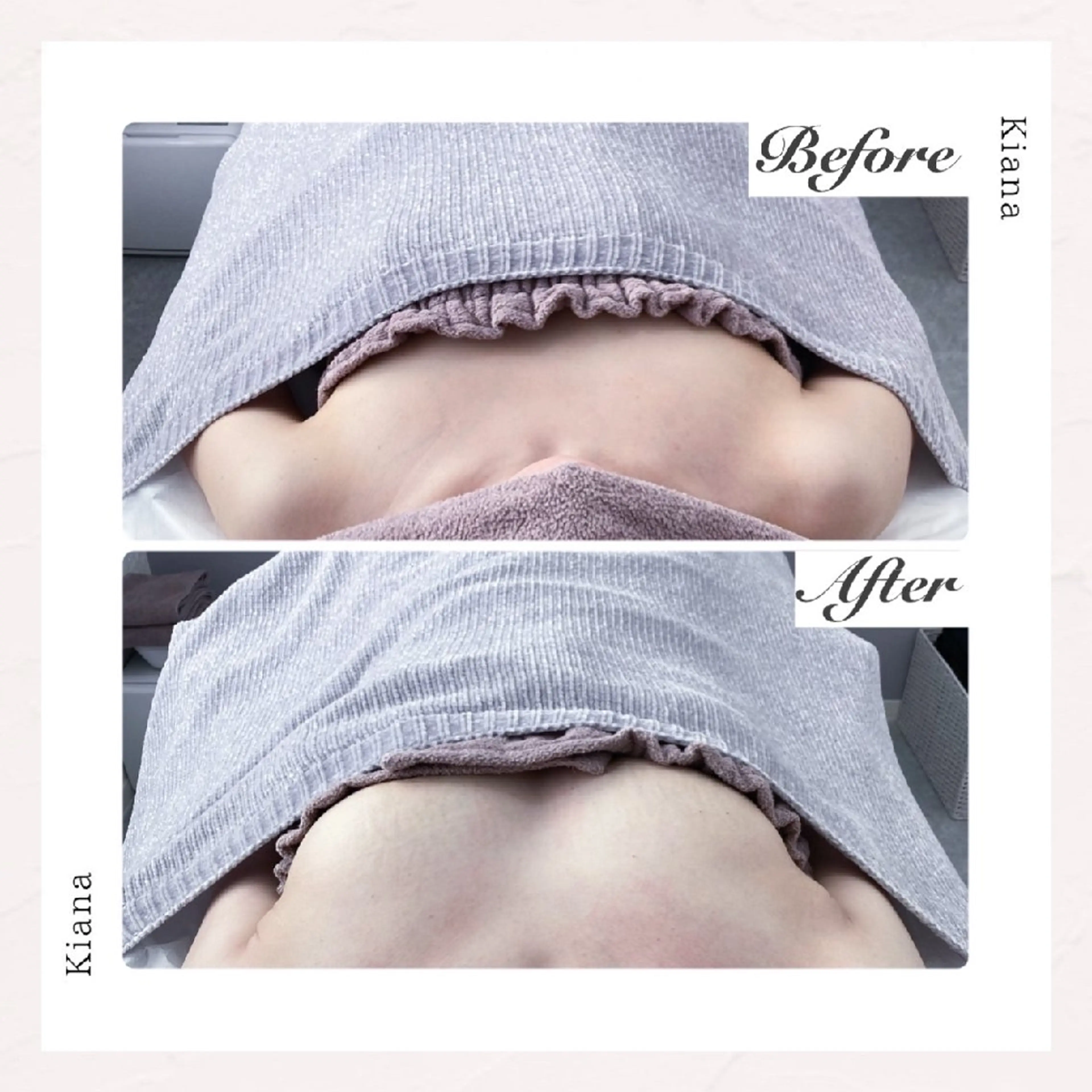 【バスト専門店 】 Kiana のエステ・リラクイメージ