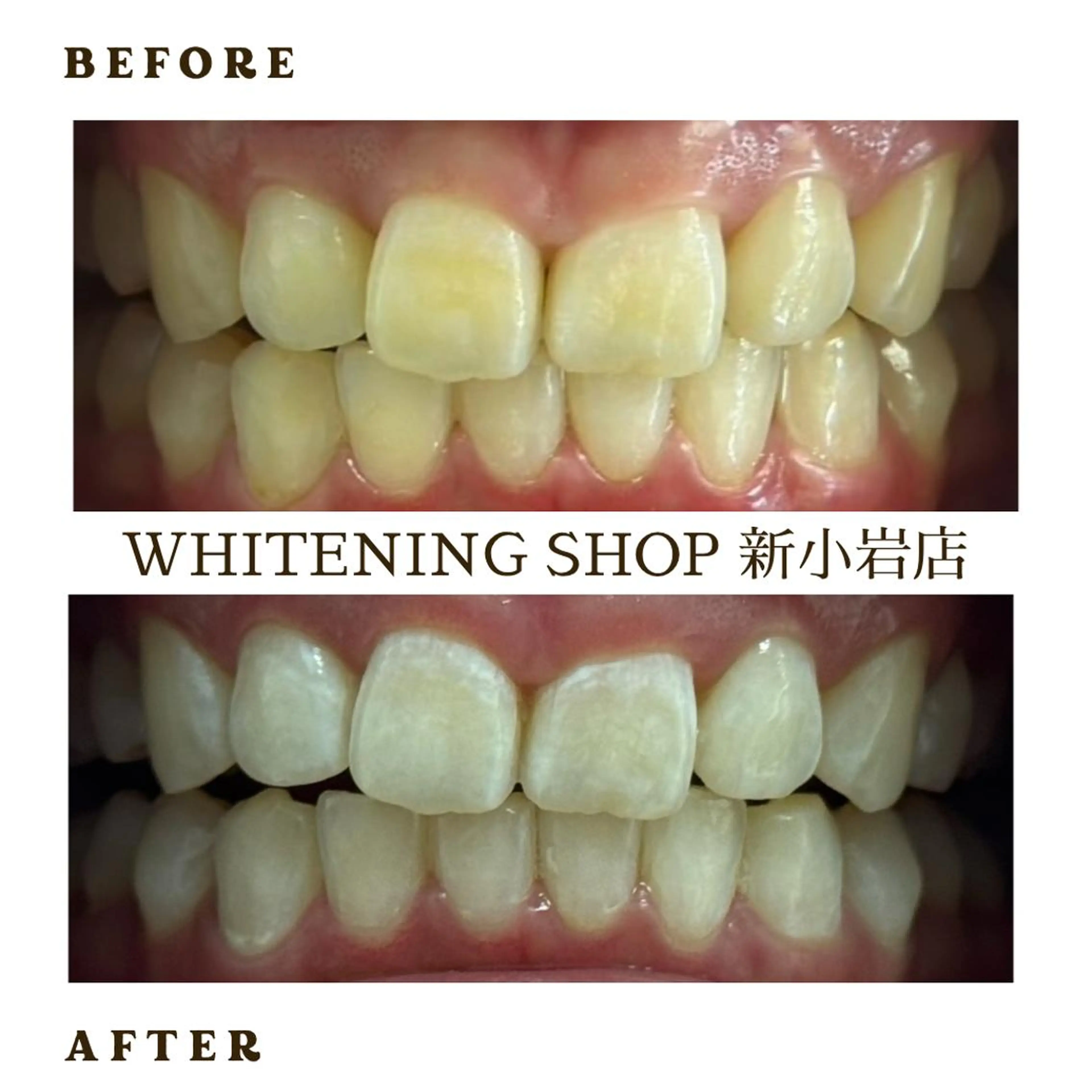 メンズ その他 ホワイトニング ショップ新小岩店のその他イメージ