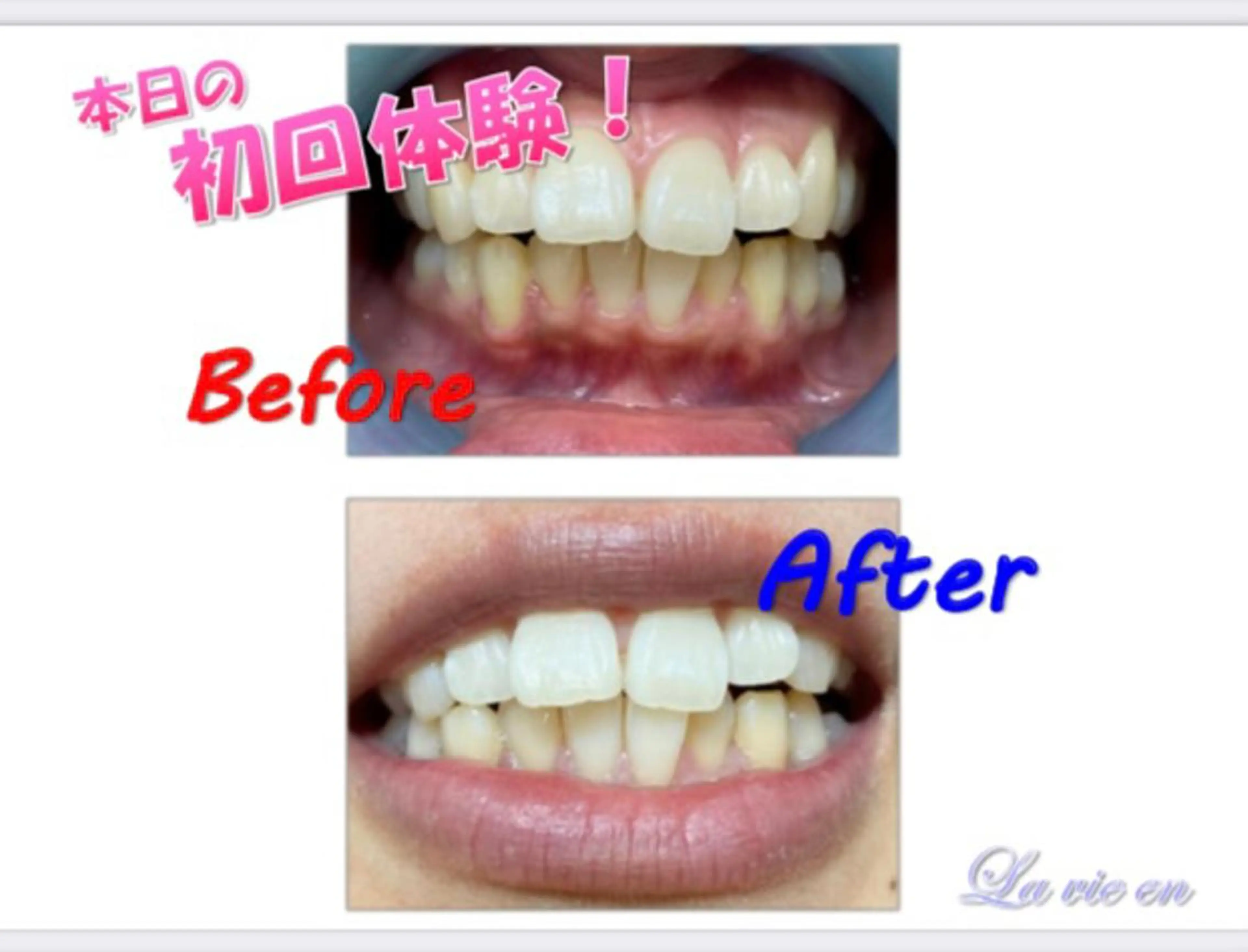 その他 セルフホワイトニングサロン　ラヴィアン所属・ホワイトニングサロン La vie enのその他イメージ