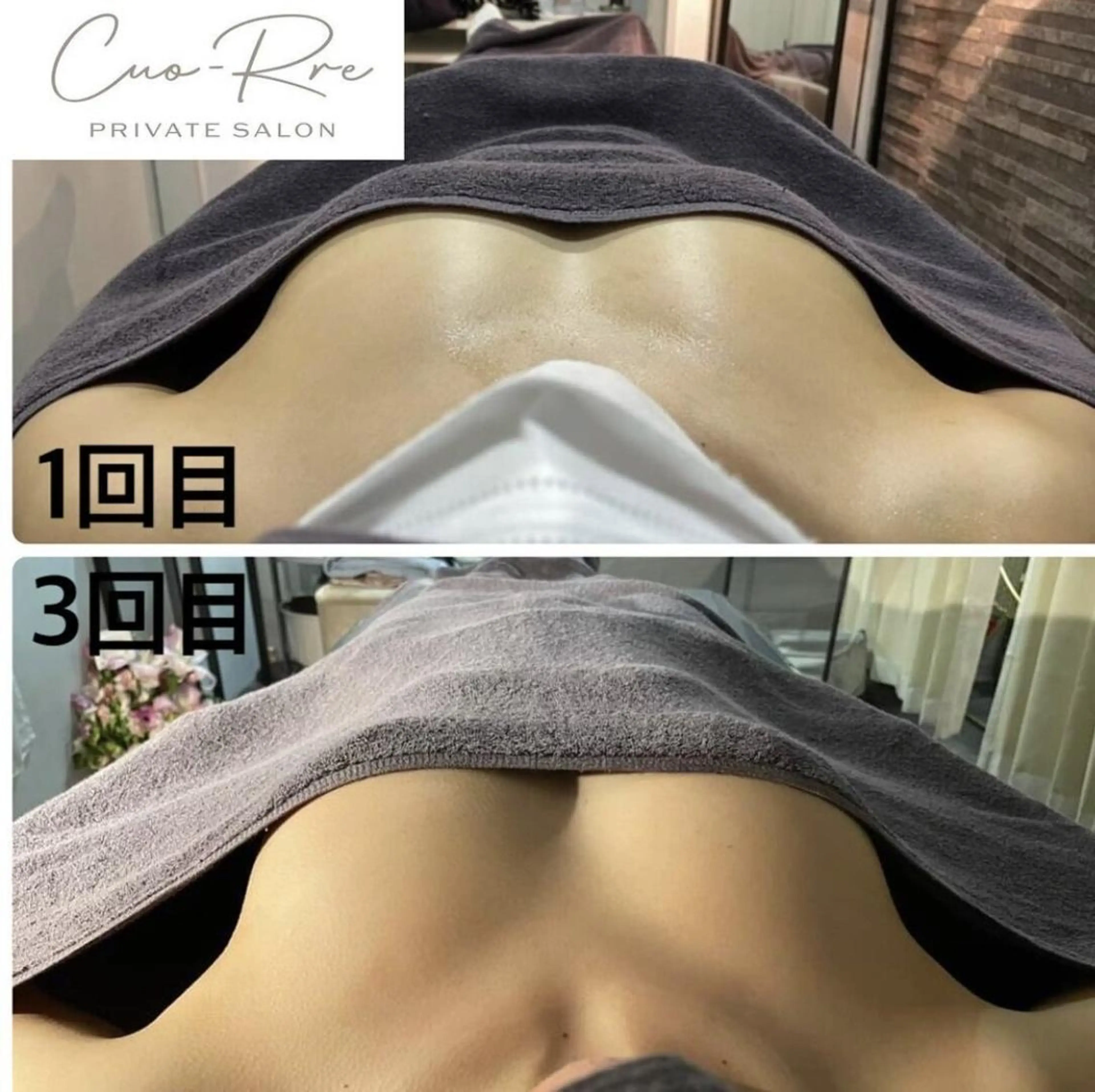 【最新NR機器NINE式バスト施術】ボリュームUPバストケア¥29,800の写真