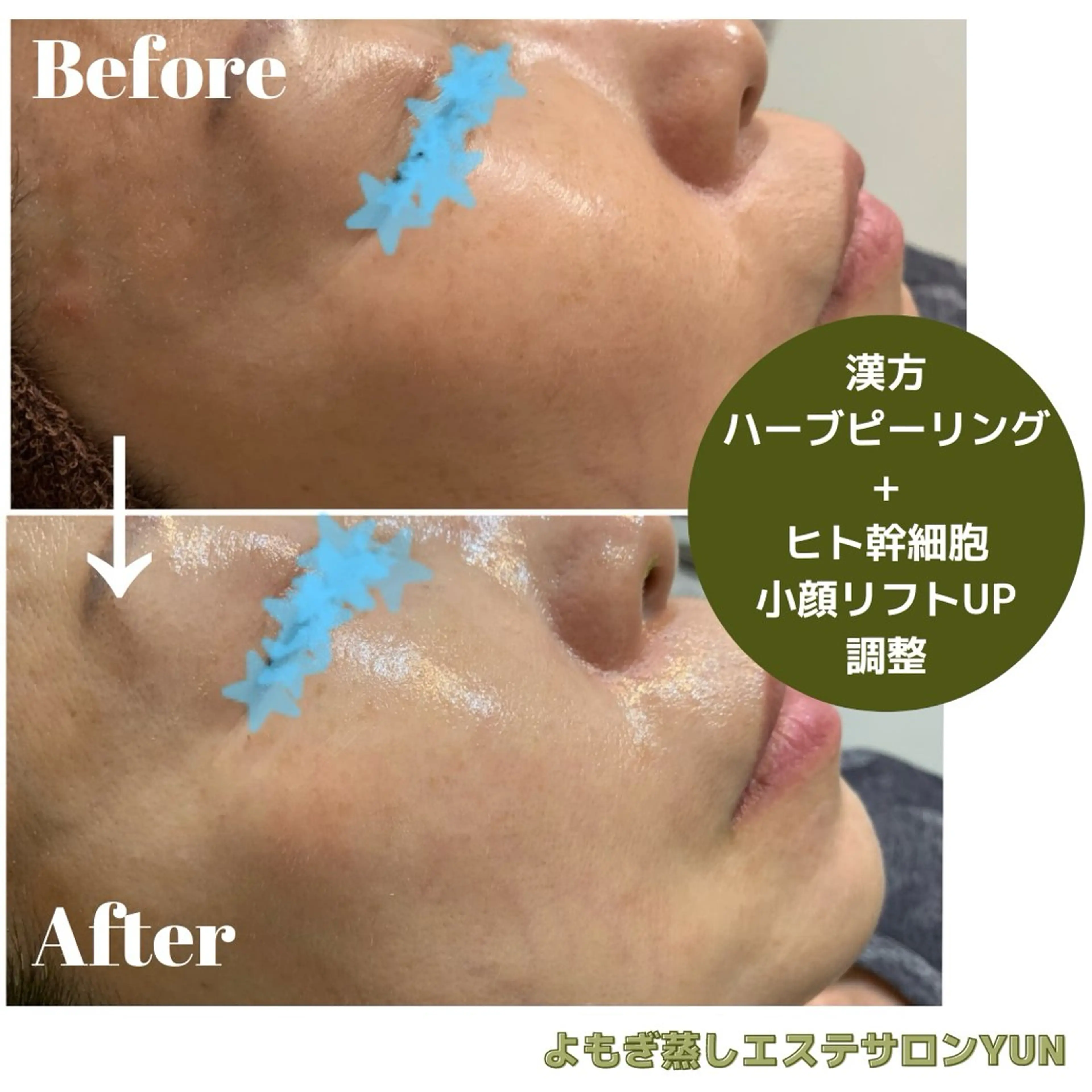 エステ よもぎ蒸しエステサロン★yun所属・よもぎ蒸しサロン ゆんのエステ・リラクイメージ