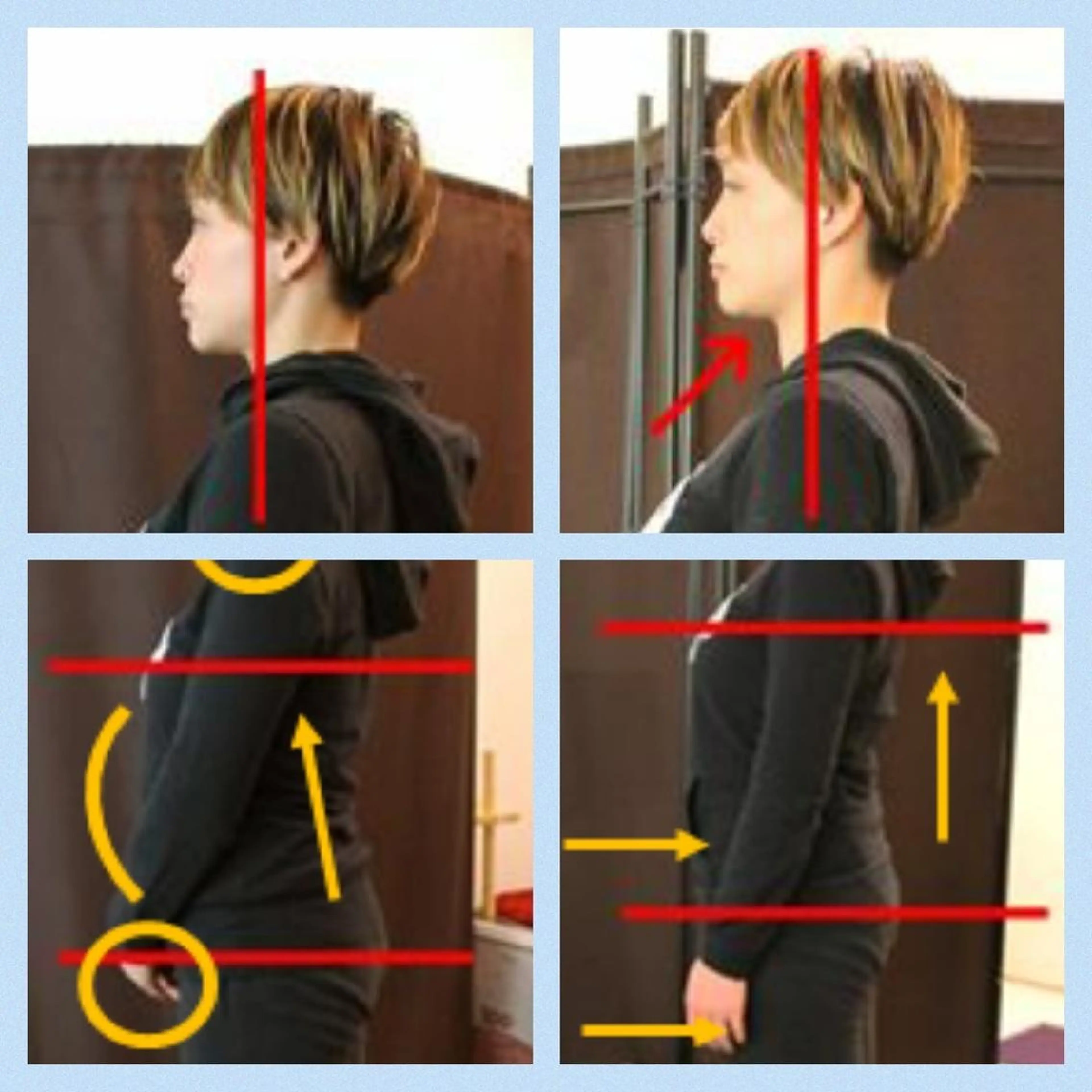 姿勢矯正スッキリケア ≪オススメ≫の写真