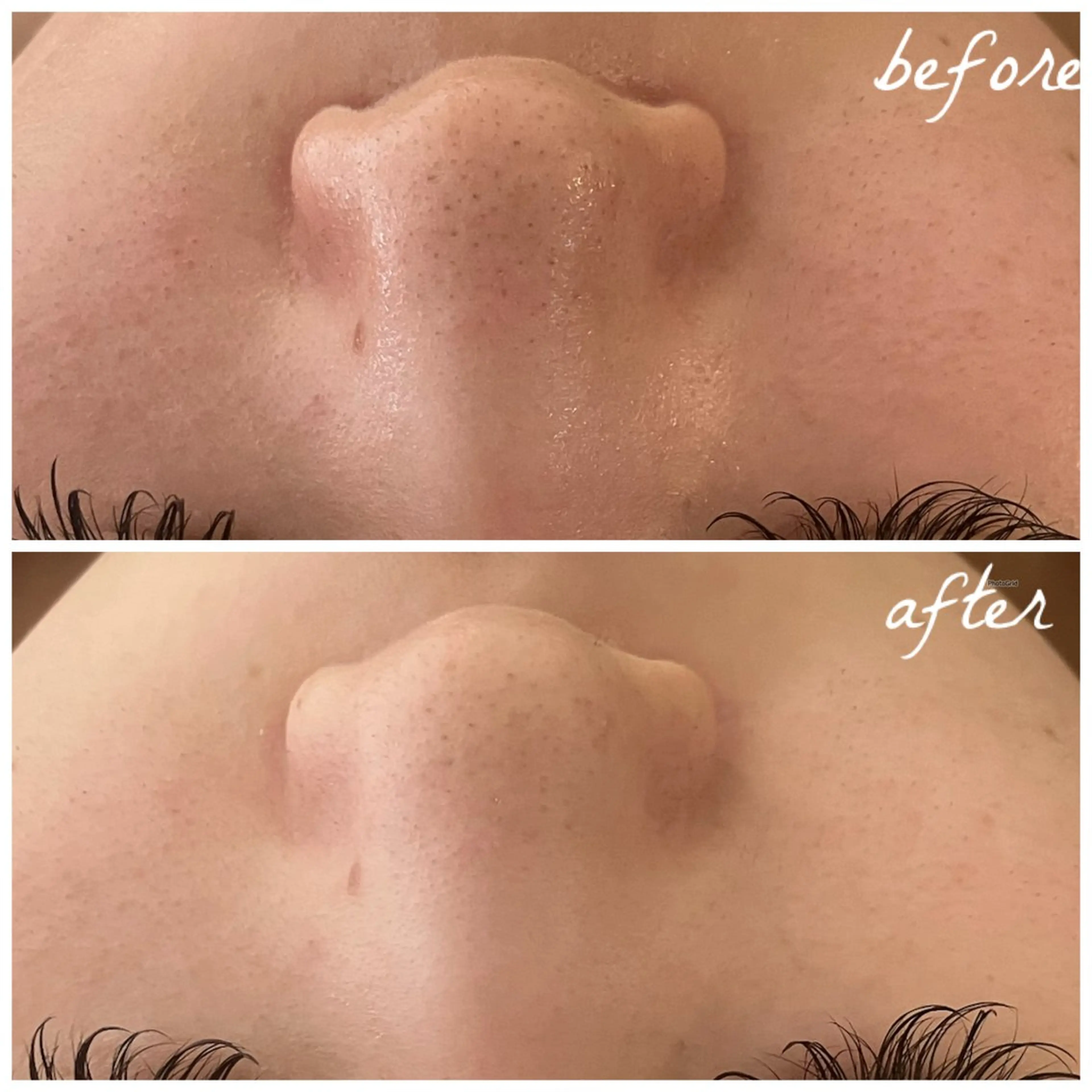 メンズ エステ メナード岐阜茜部 杉浦のエステ・リラクイメージ