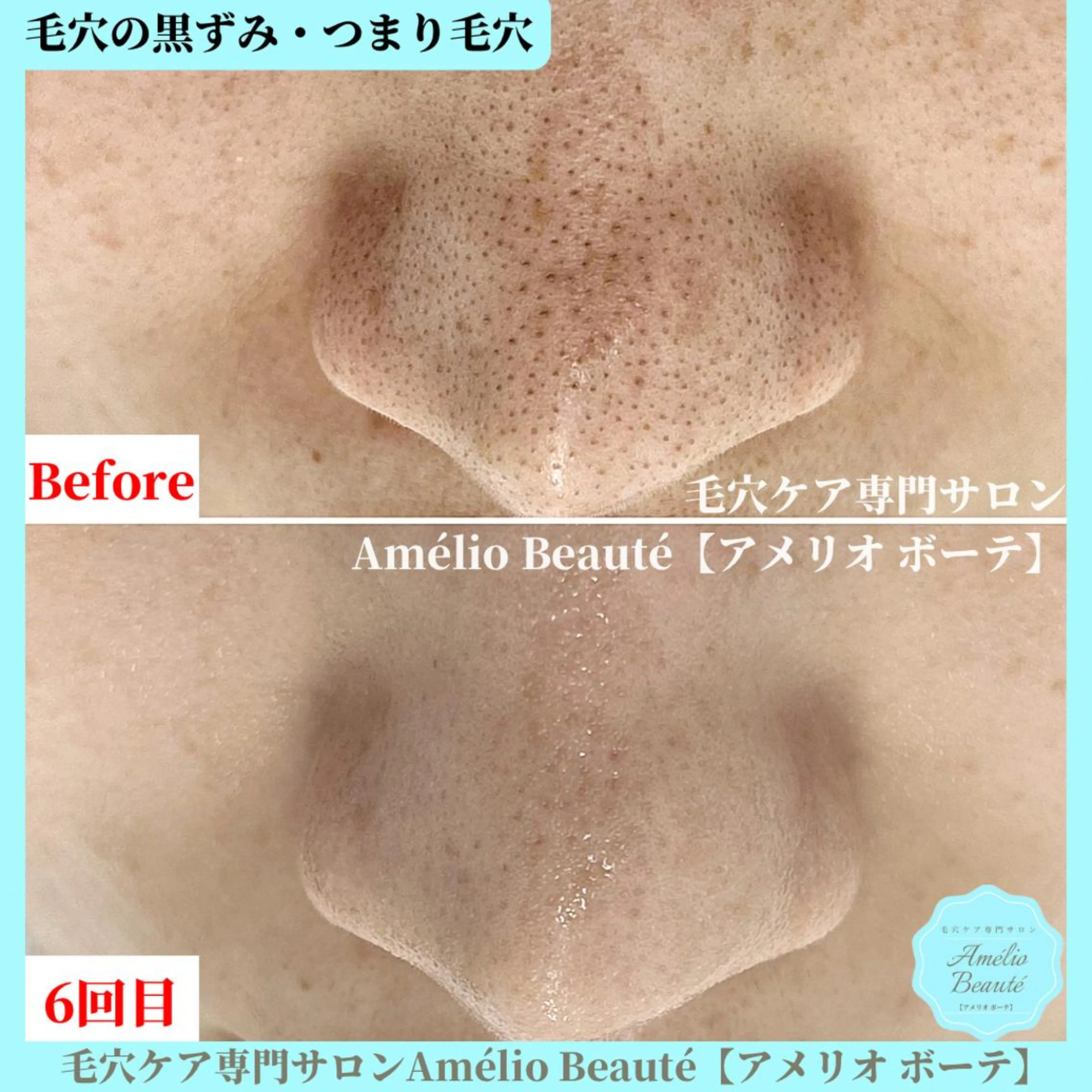 毛穴ケア専門サロン Amélio Beauté所属・毛穴ケア専門サロン アメリオボーテのその他イメージ