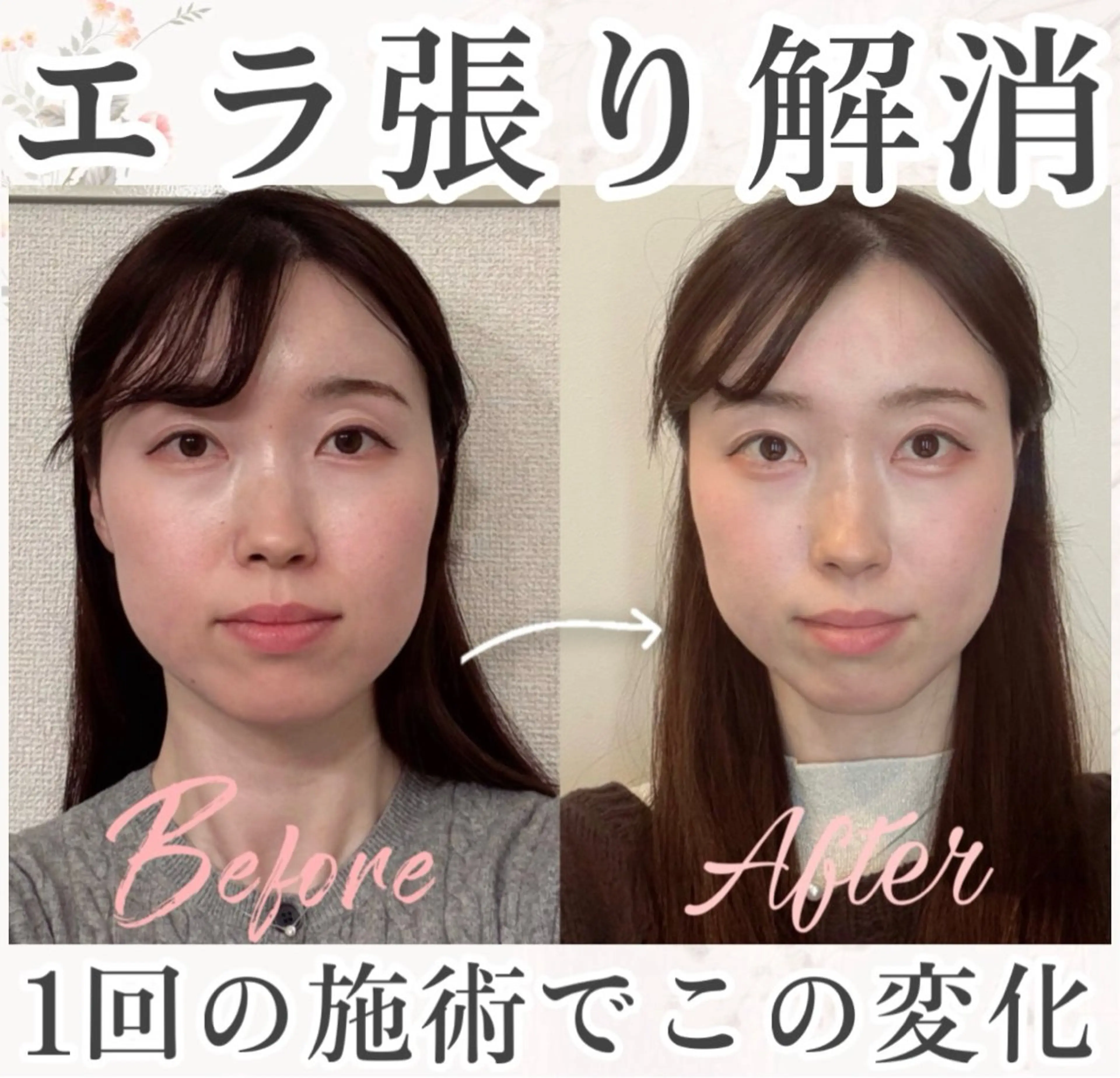 小顔矯正専門サロンAxiune所属・小顔矯正専門 🪽アシュネ平野のエステ・リラクイメージ