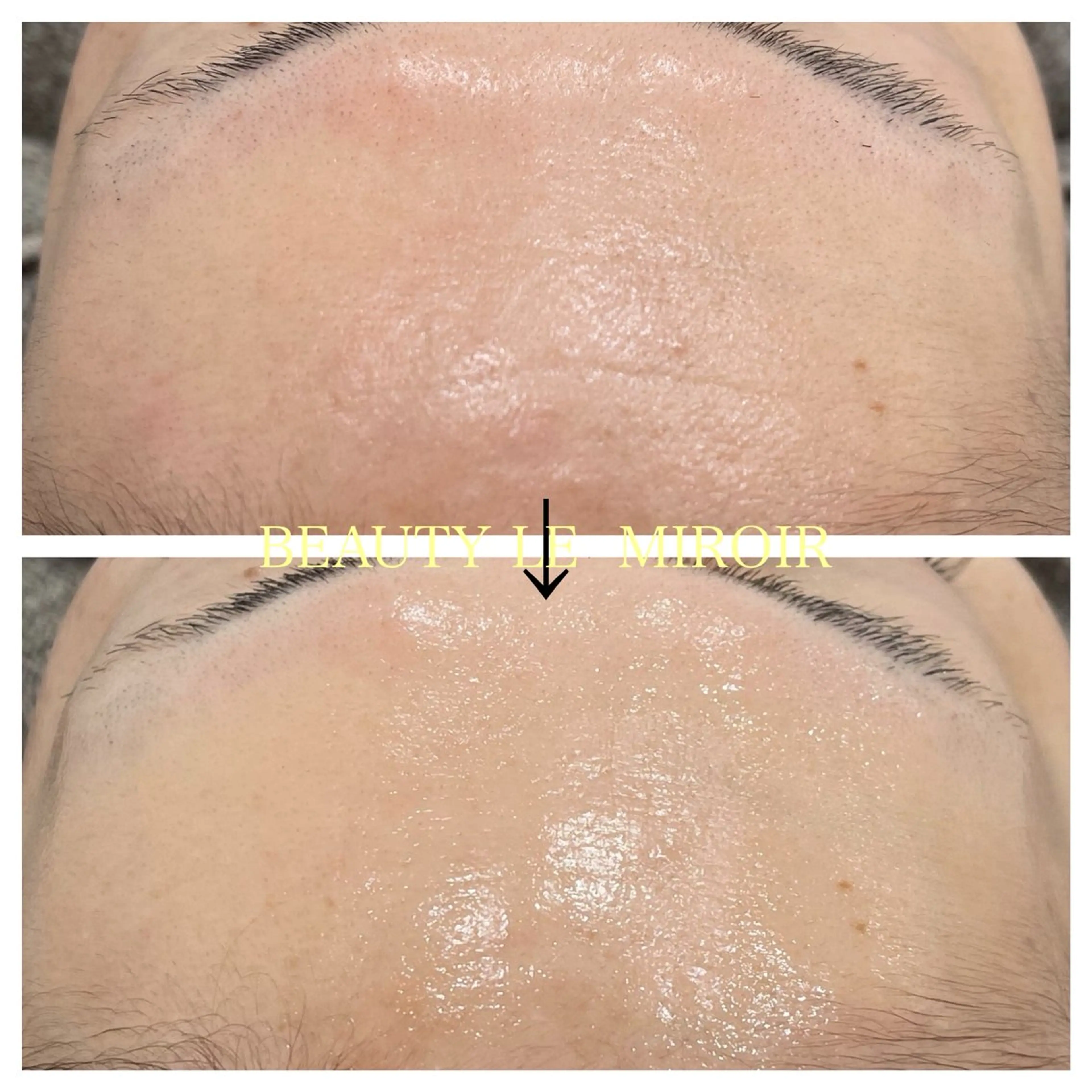 エステ ビューティー ミロワールのエステ・リラクイメージ