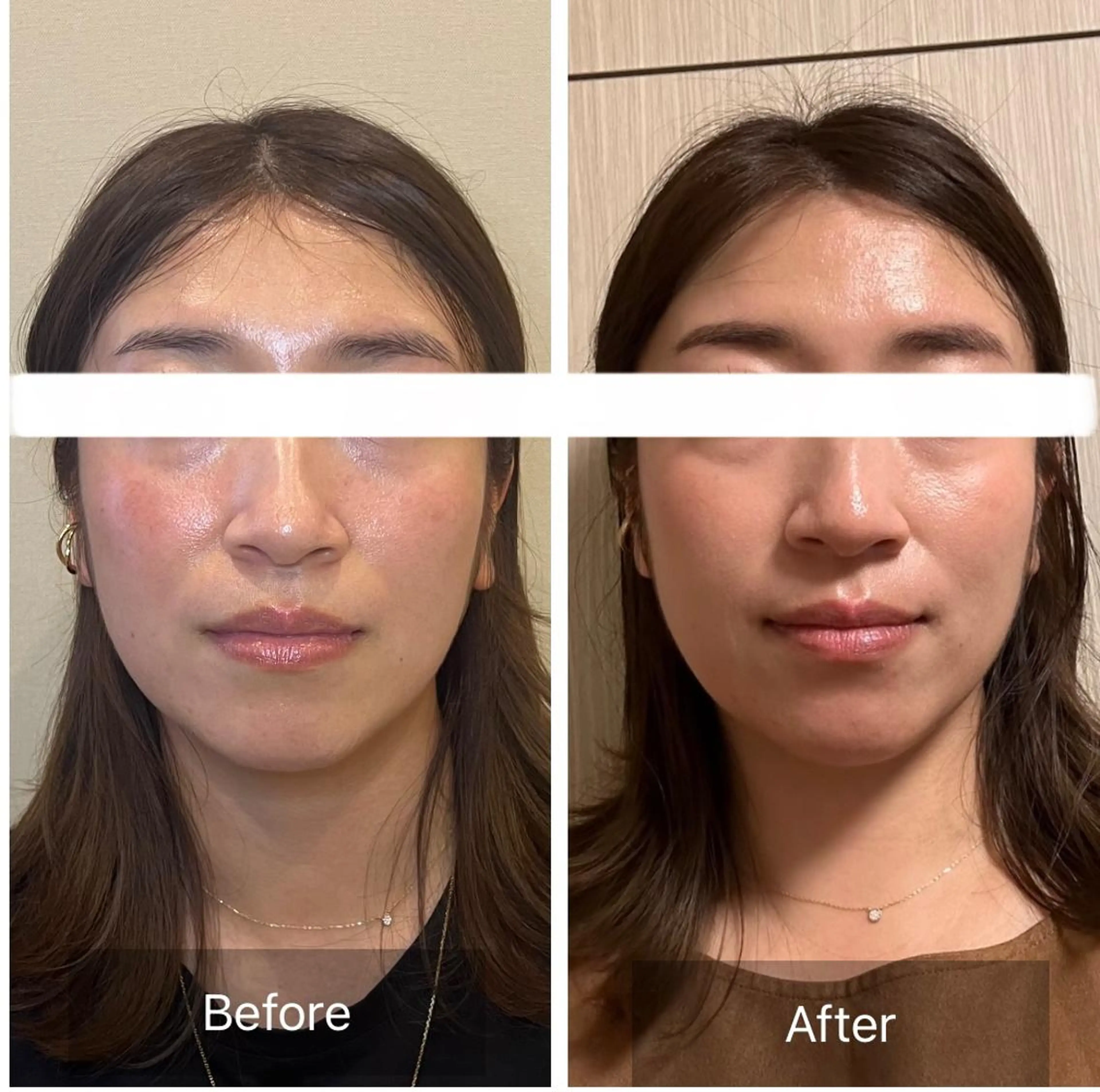 エステ 柳瀬 絵美のマツエク・マツパデザイン