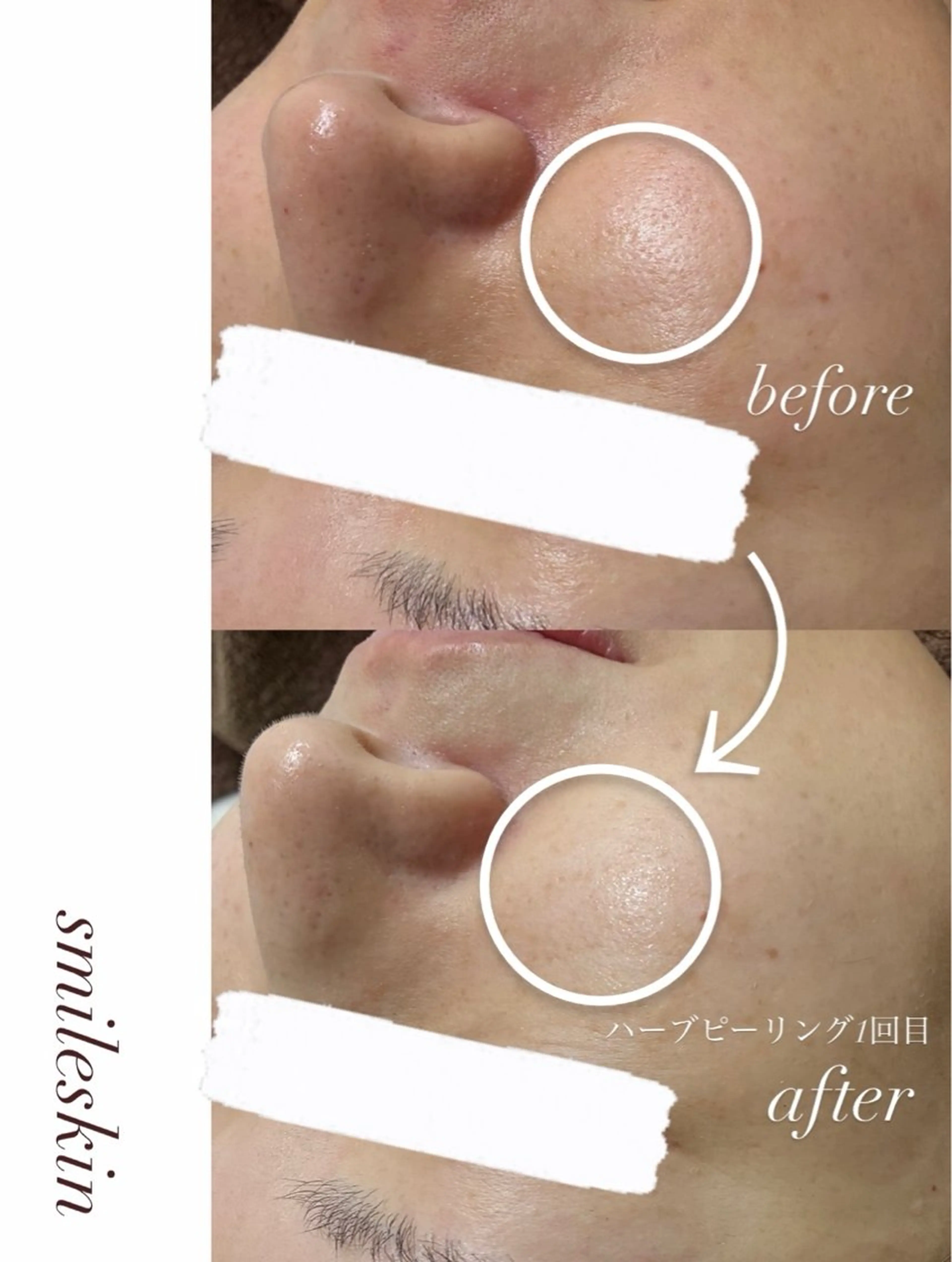 その他 smileskin 京都／meguのその他イメージ