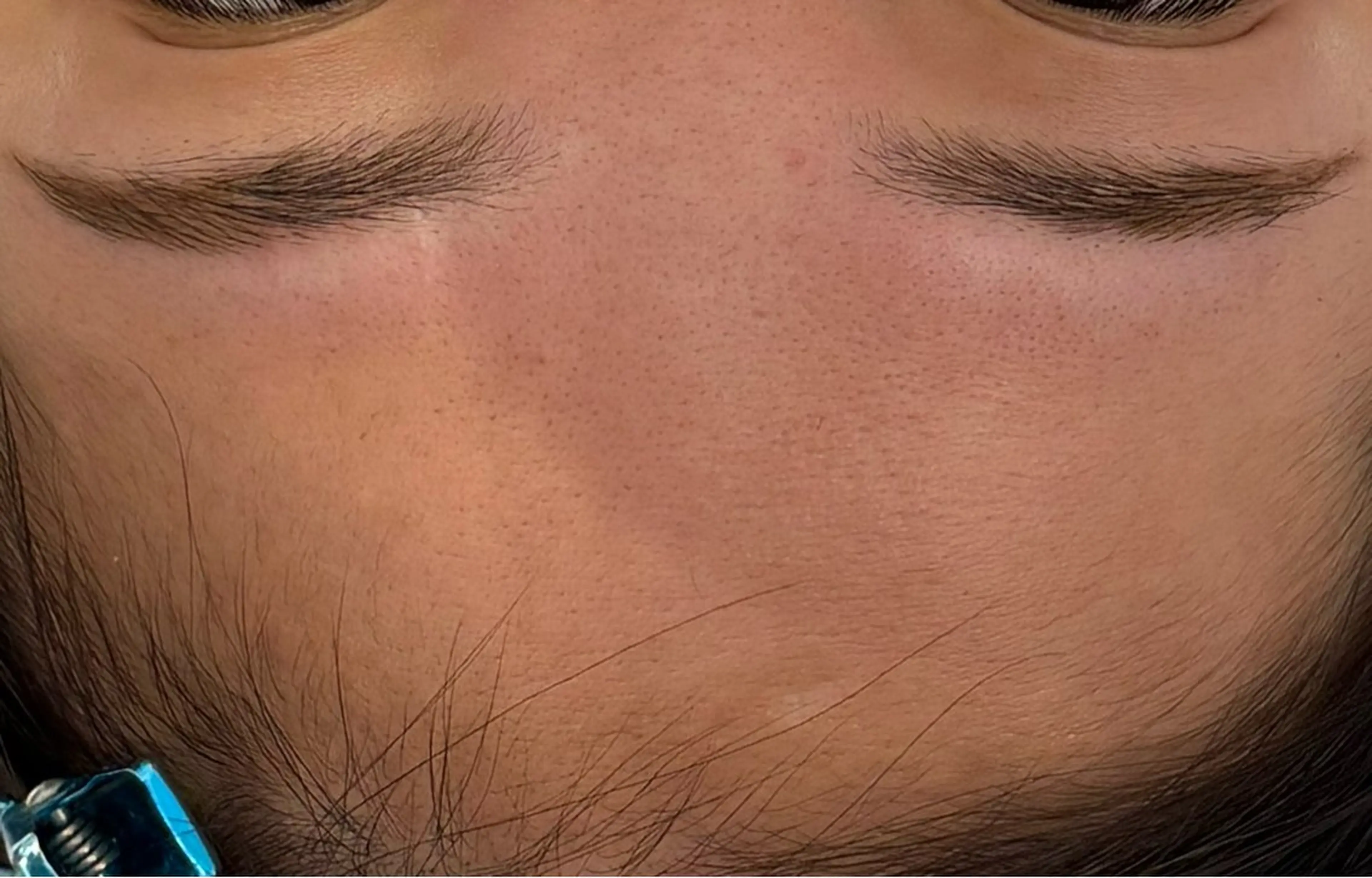 べアール所属・小顔/毛穴/ニキビ salon bealのその他イメージ