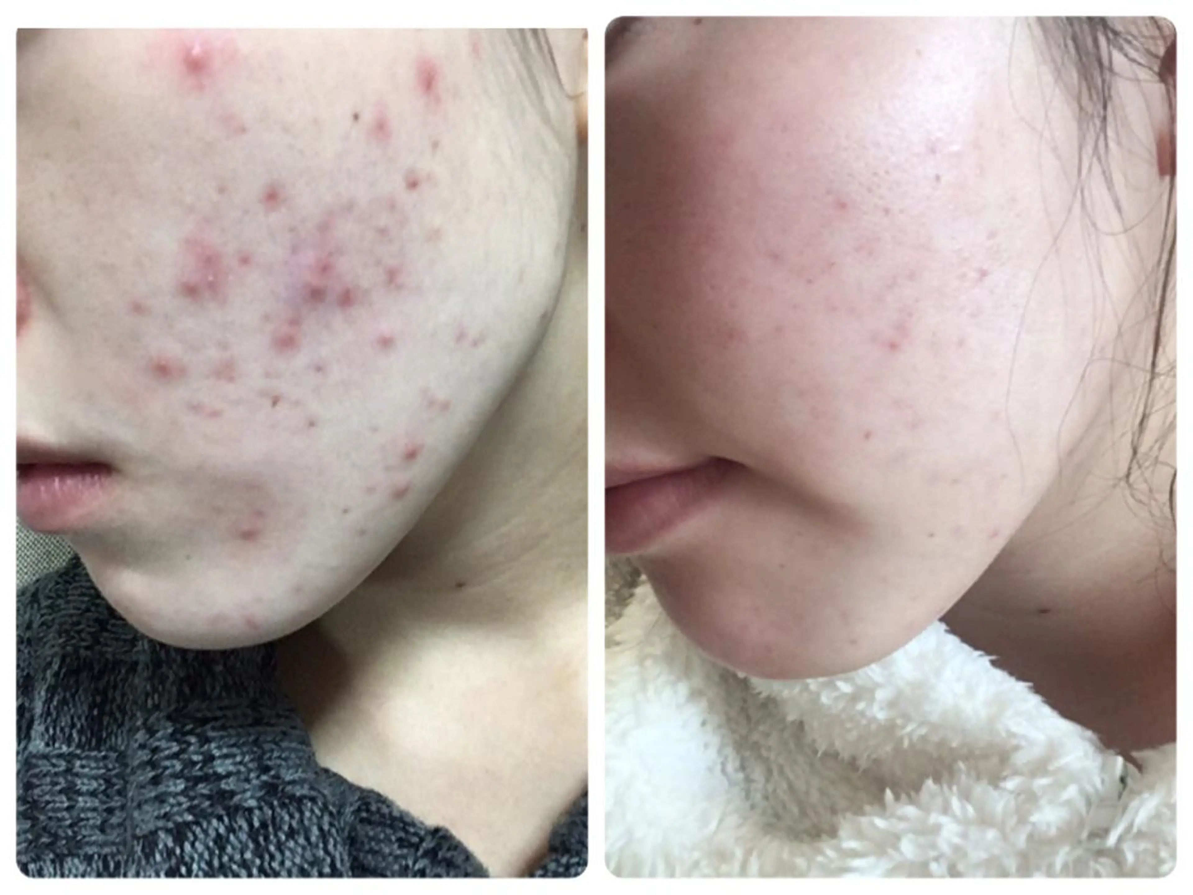 プライベートサロン Perla所属・Perla 齊藤のマツエク・マツパデザイン