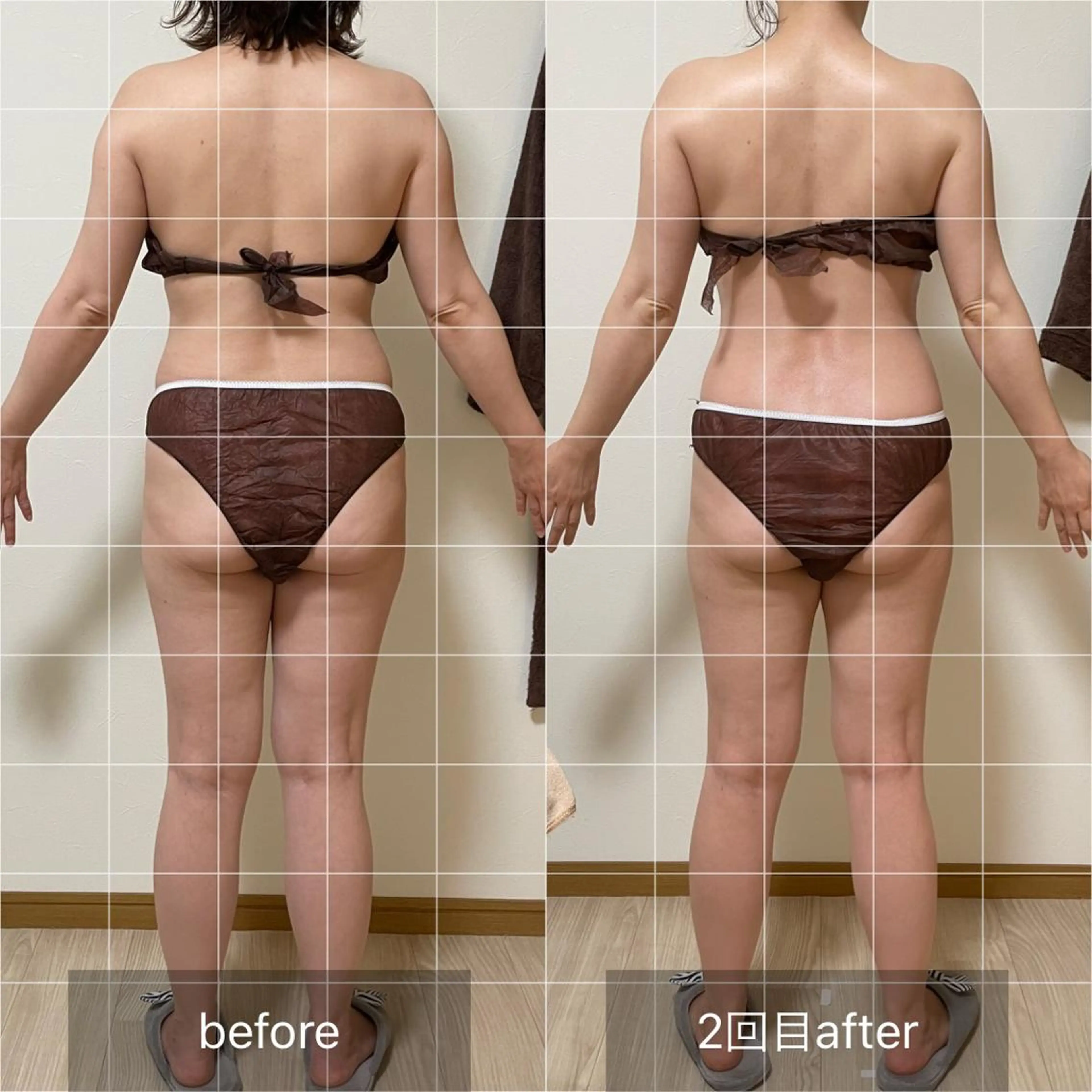 未病ケアサロン　EMINY所属・未病ケアサロン EMINY☺︎勝俣のエステ・リラクイメージ