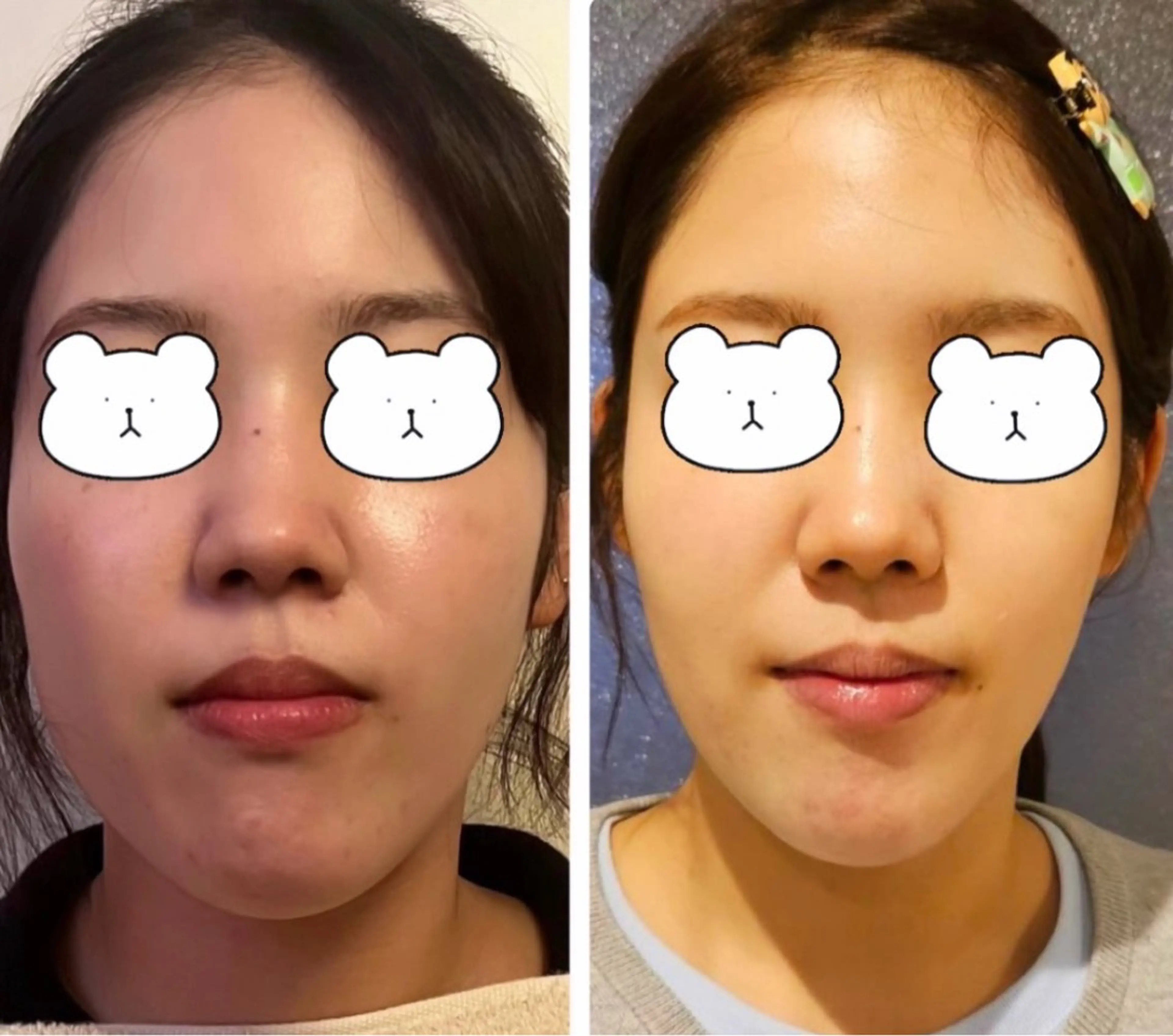 ■ 美ﾎﾞﾃﾞｨﾘﾘｰｽ➕頭小顔美骨ｺﾙｷﾞ 50分Massage to make your face smallerの写真